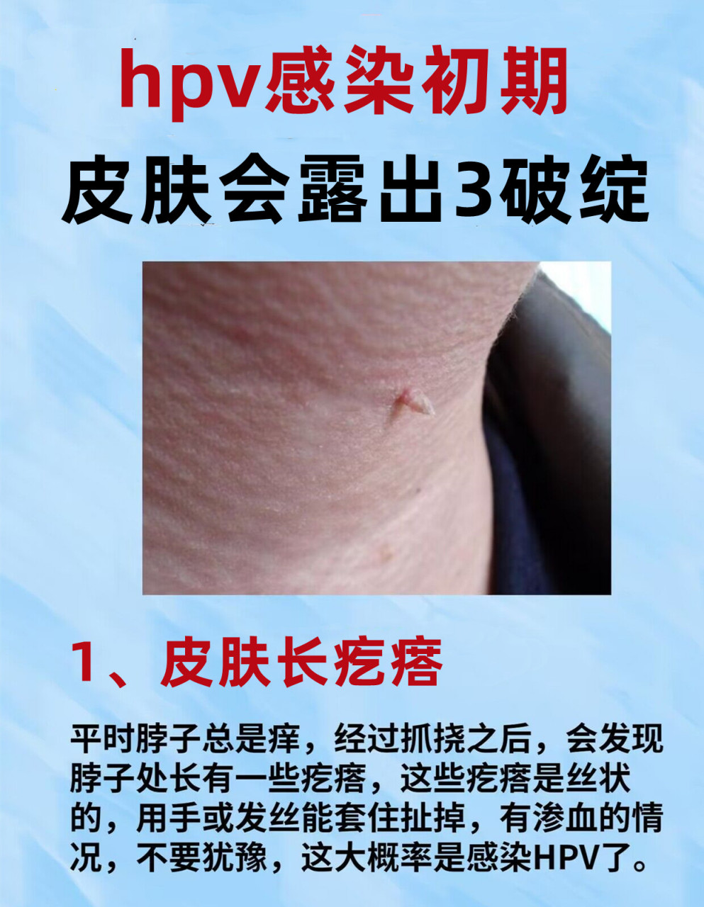 hpv感染初期,皮肤会有3个"破绽"!