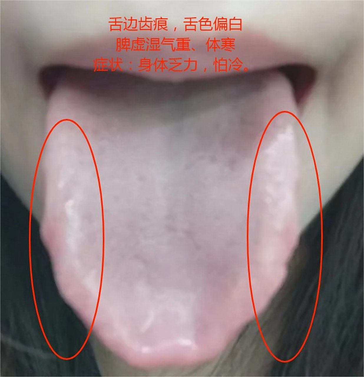 健康问题舌象知道,舌诊分析图,可以看一下#健康养生# #舌诊# #舌象