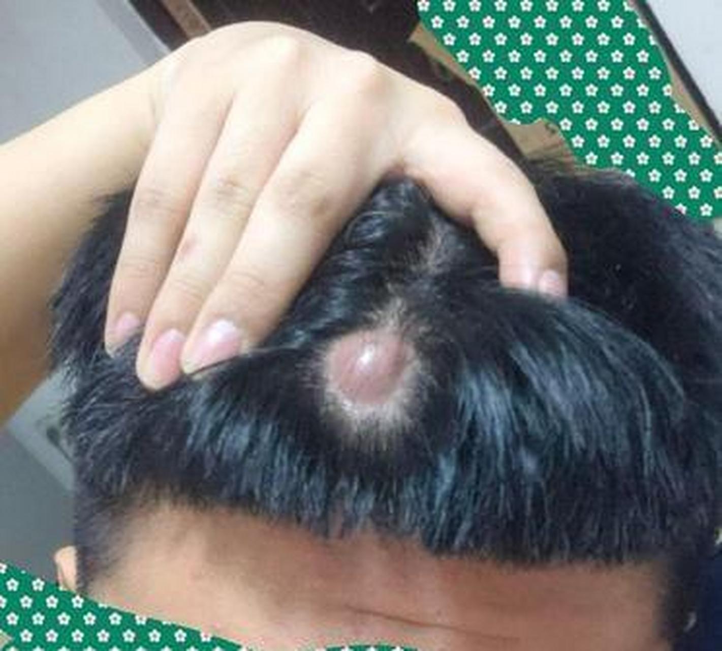 原来头上长摄像头是这么样的哇!