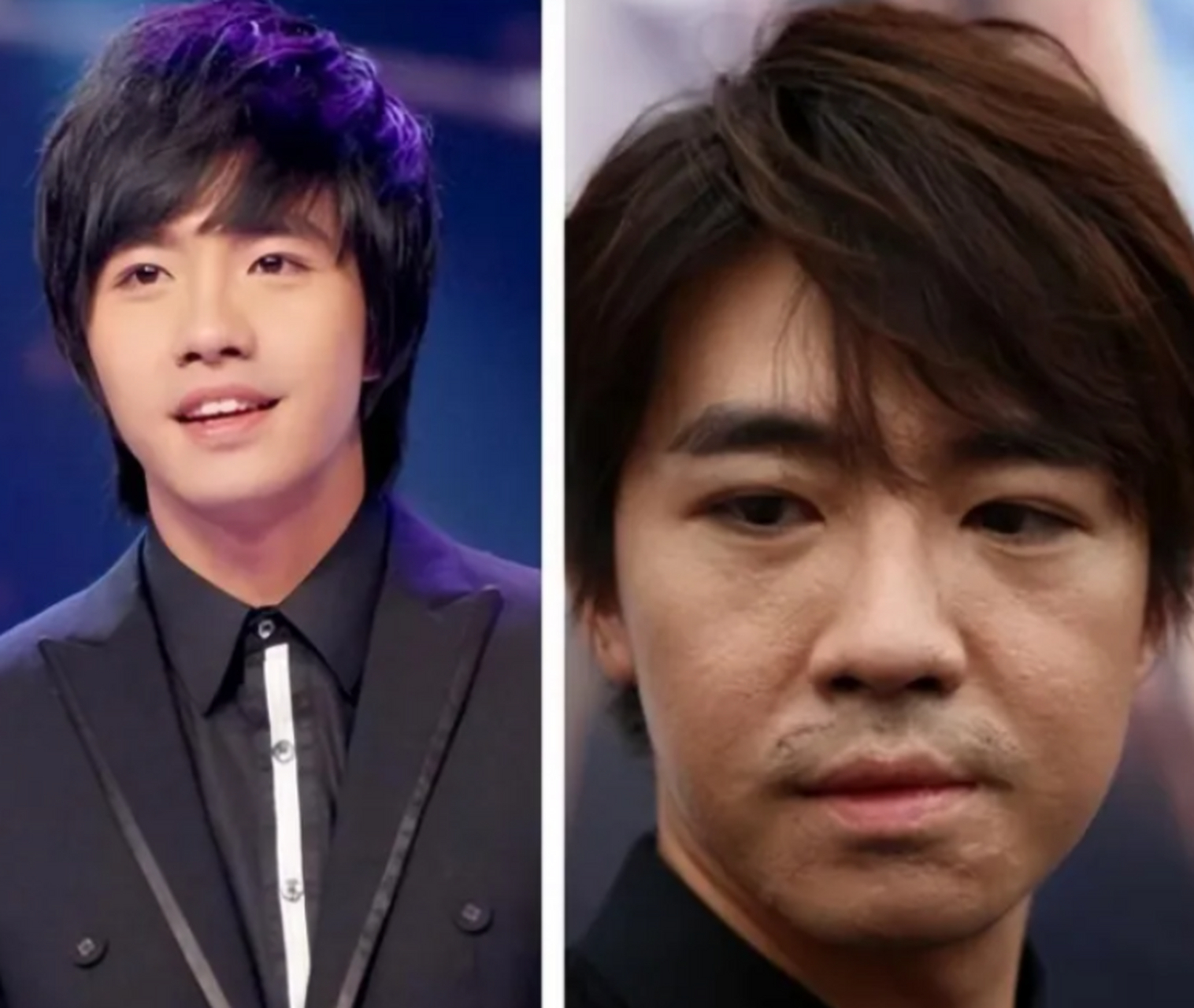 况且自己的烧伤程度高达54%,比俞灏明还要严重,理应优先使用担架,并不