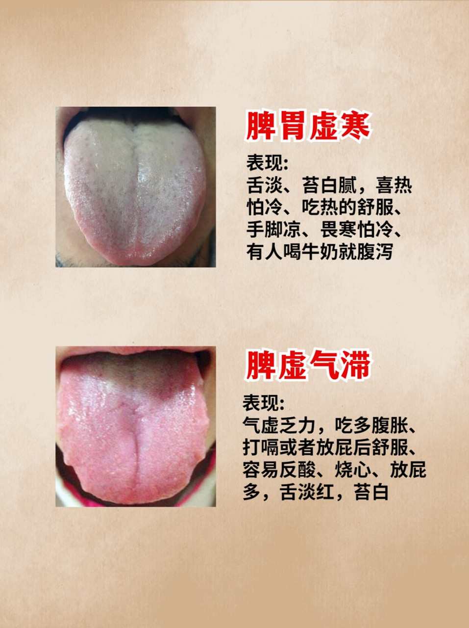 怎样的舌苔算正常图片图片