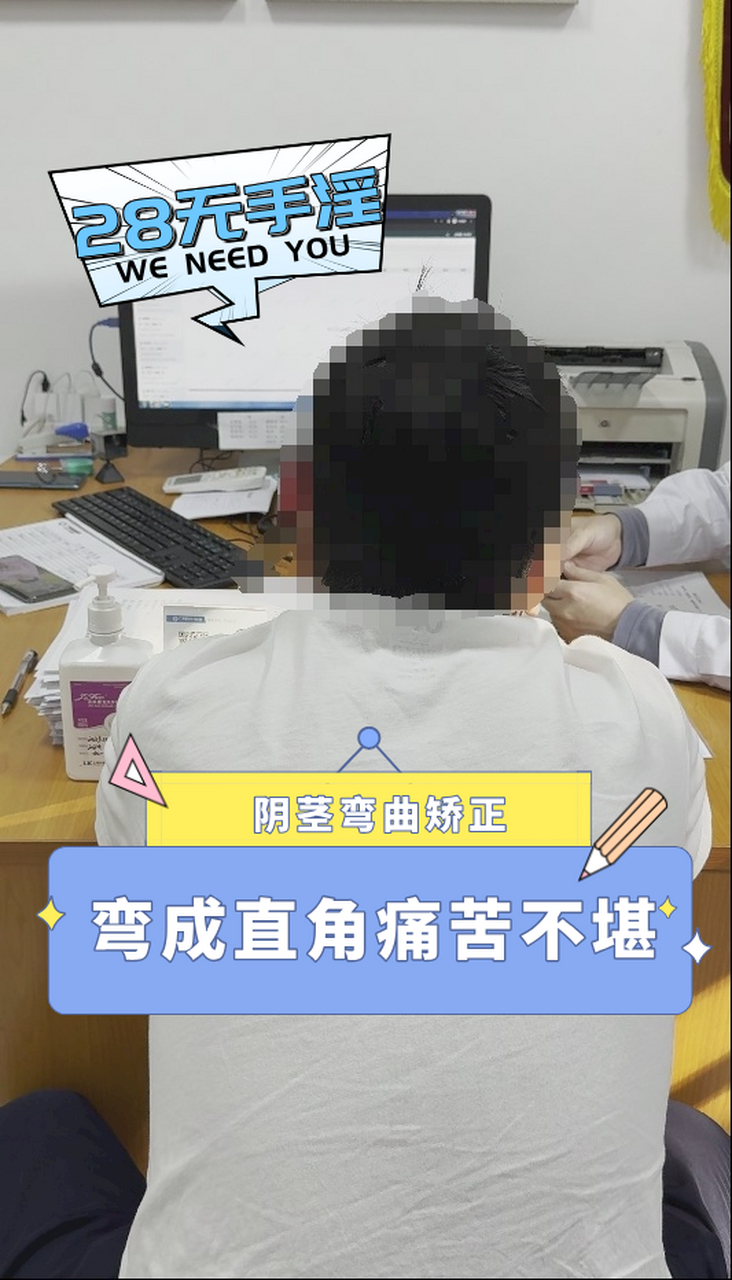 今日案例分享 今天给一位接近直角(90°)重度弯曲阴茎的李先生做矫正