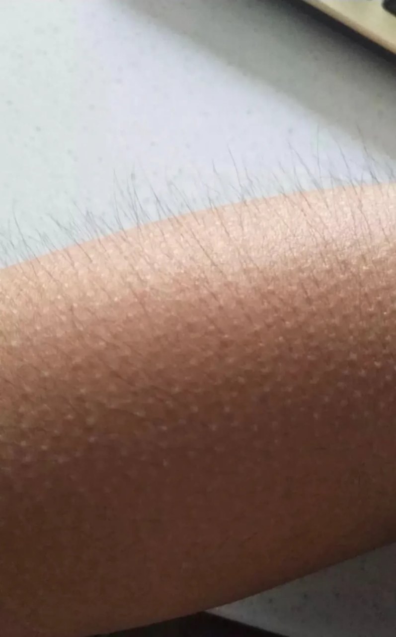 为什么这个孩子有三排牙齿? 我浑身起鸡皮疙瘩,毛骨悚然![大笑][大笑]