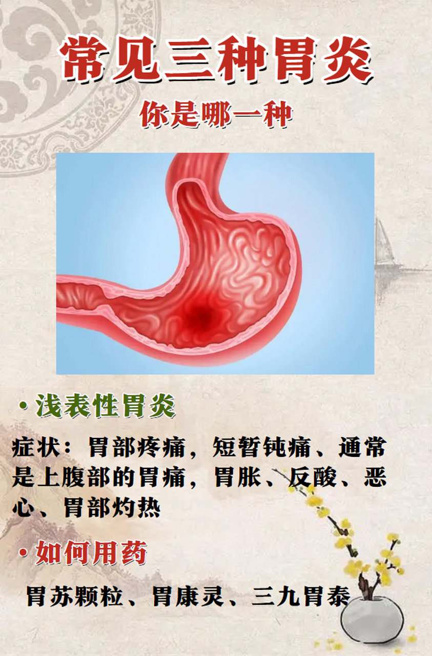 常见三种胃炎,分别什么症状,如何用药呢?