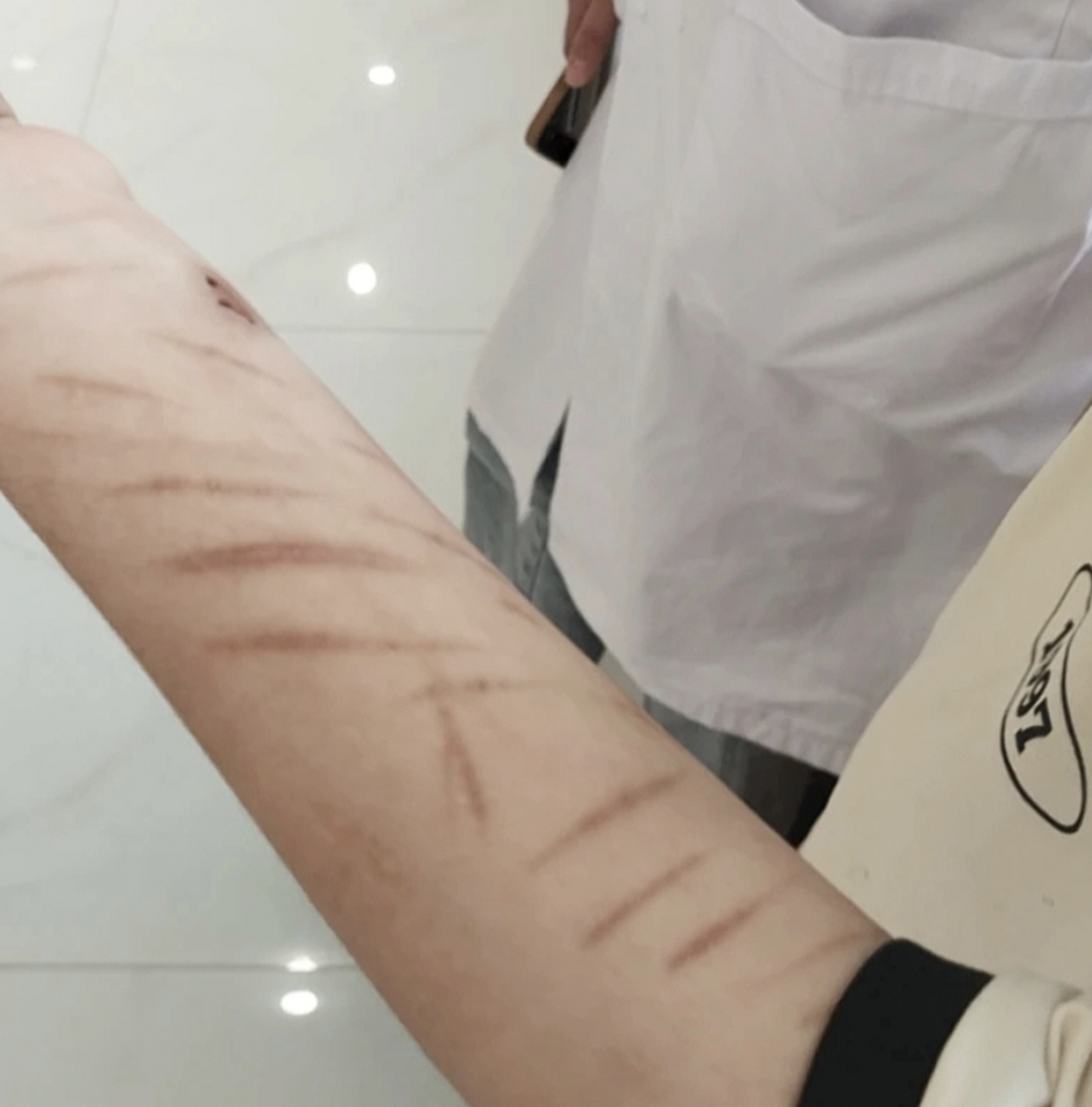 我知道你很痛苦,内心很压抑,又没有宣泄的方式,所以才会选择自残.