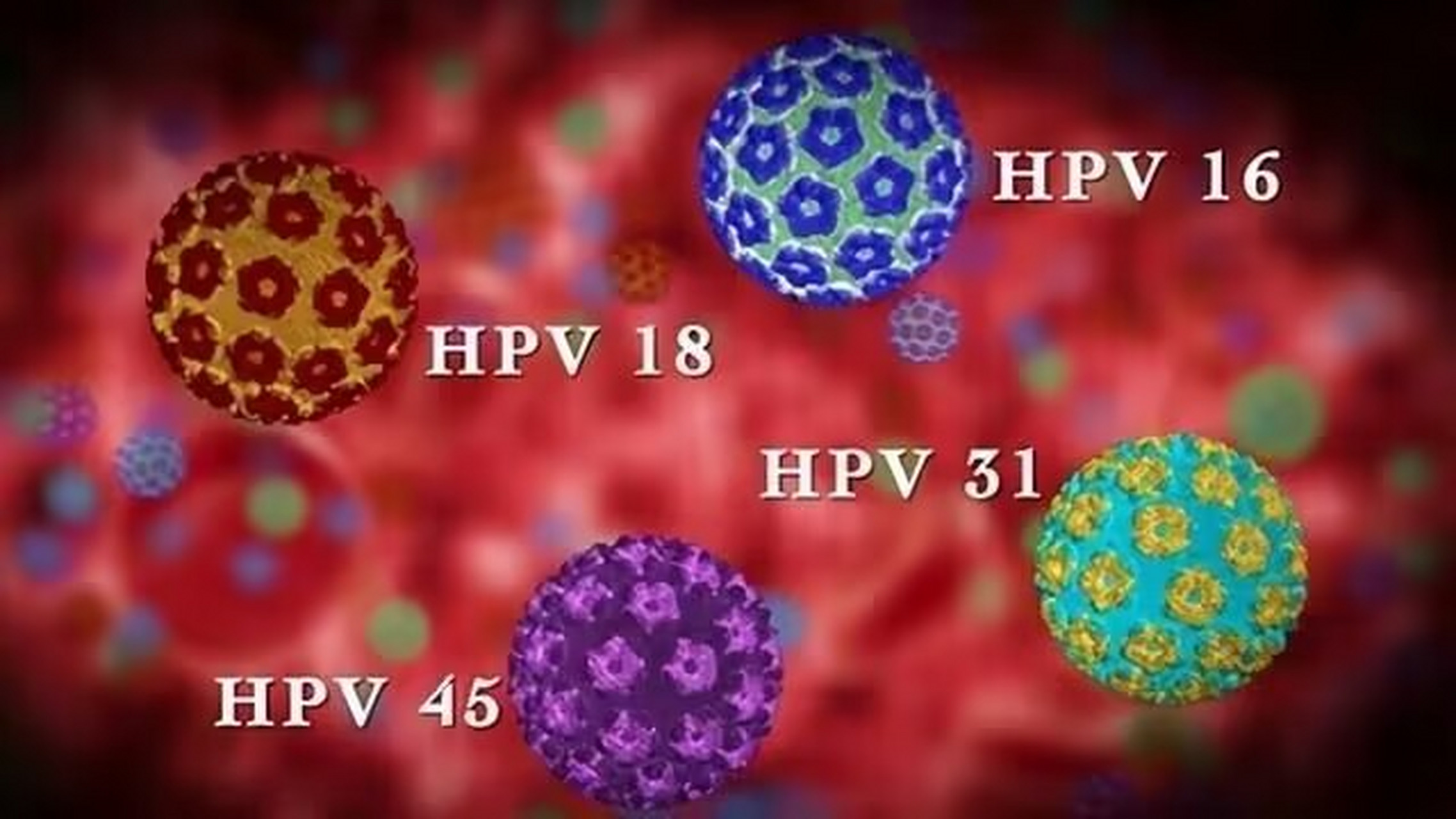 通常情况下,如果女性患有人乳头瘤病毒(hpv)16或18型感染,建议进行
