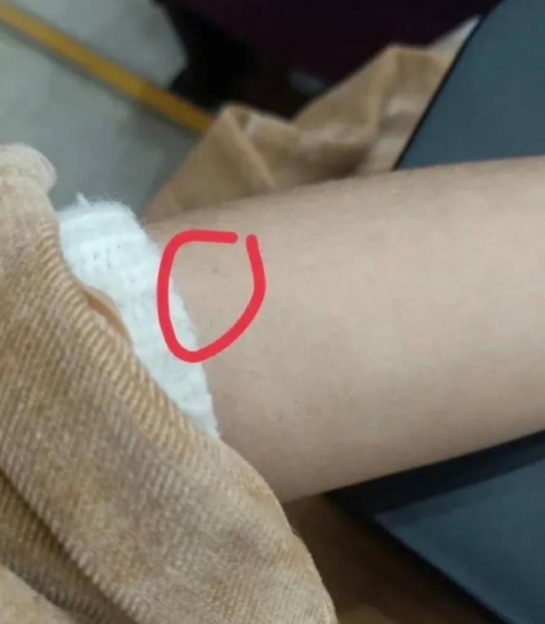 咱就是说左手臂是不是都有痣[允悲][允悲],我也有! 676767