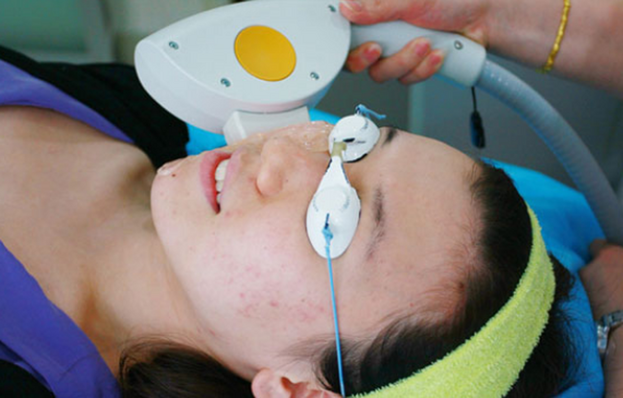 光子嫩肤适合多少年龄的人做  光子嫩肤是一种非常受欢迎的皮肤美容