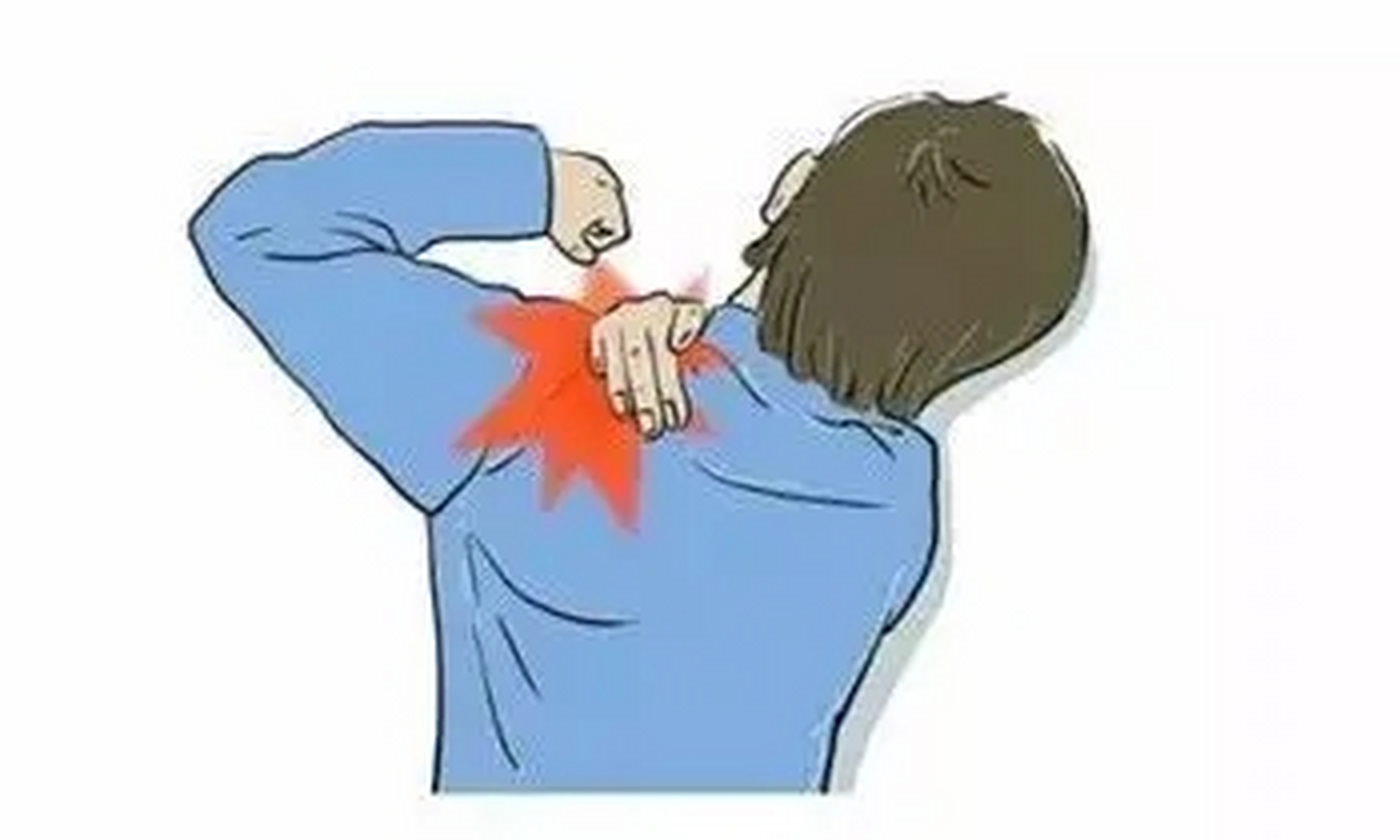 肩周炎的三个阶段要持续多长时间 冻结肩通常发展缓慢,可分为三个阶段