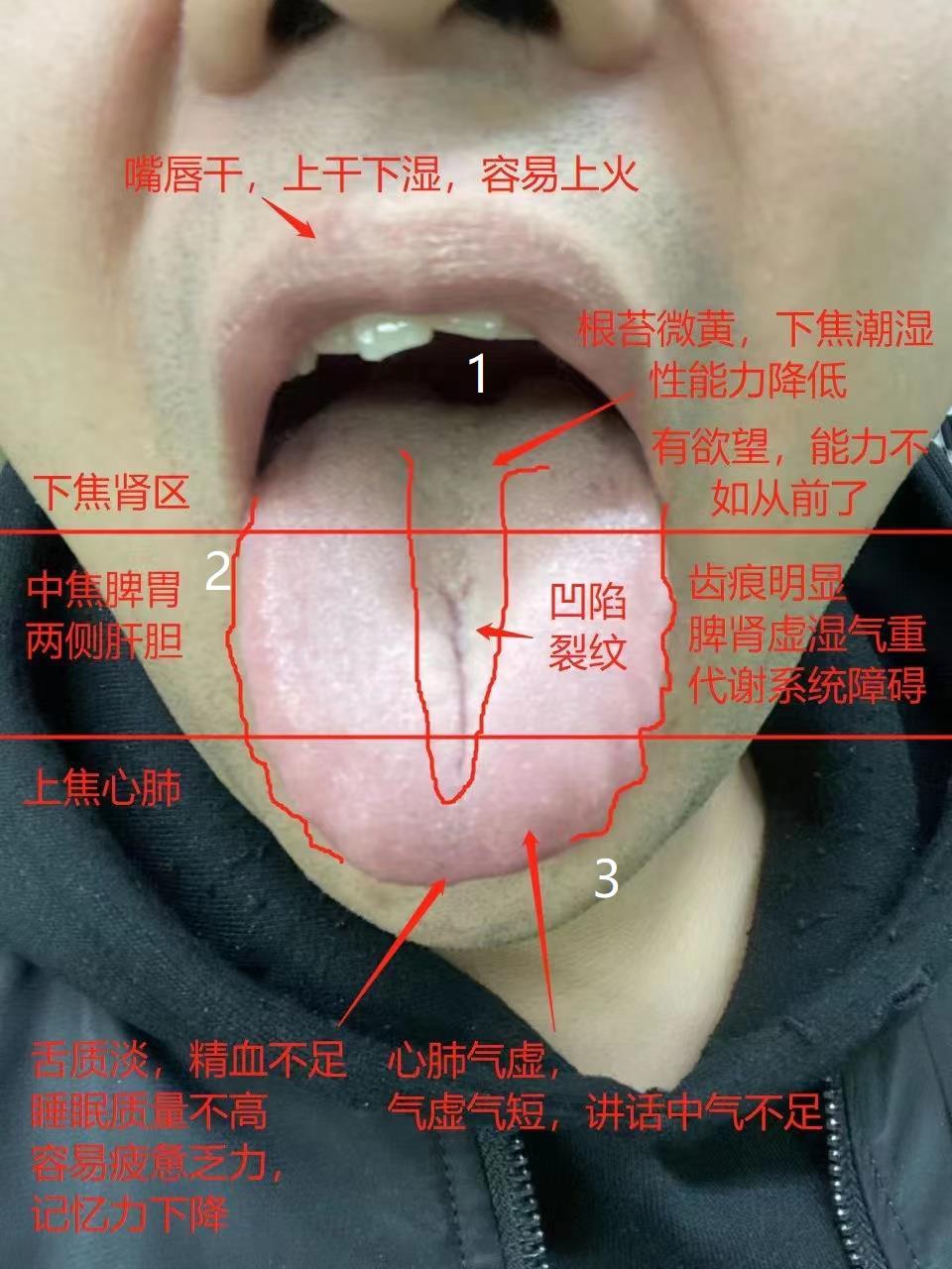 朱大夫教你看舌象!