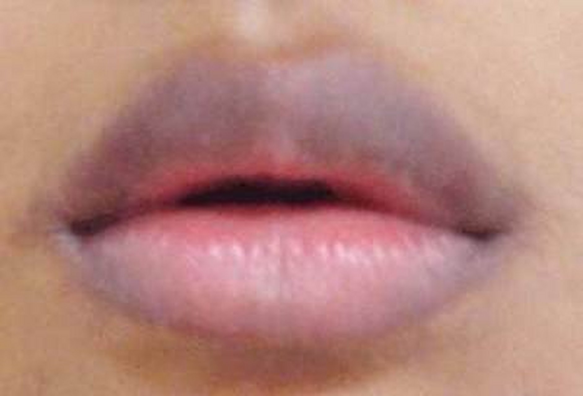 嘴唇发白 这情况中医认为多因脾胃虚弱,气血不足所导致,这类患者往往