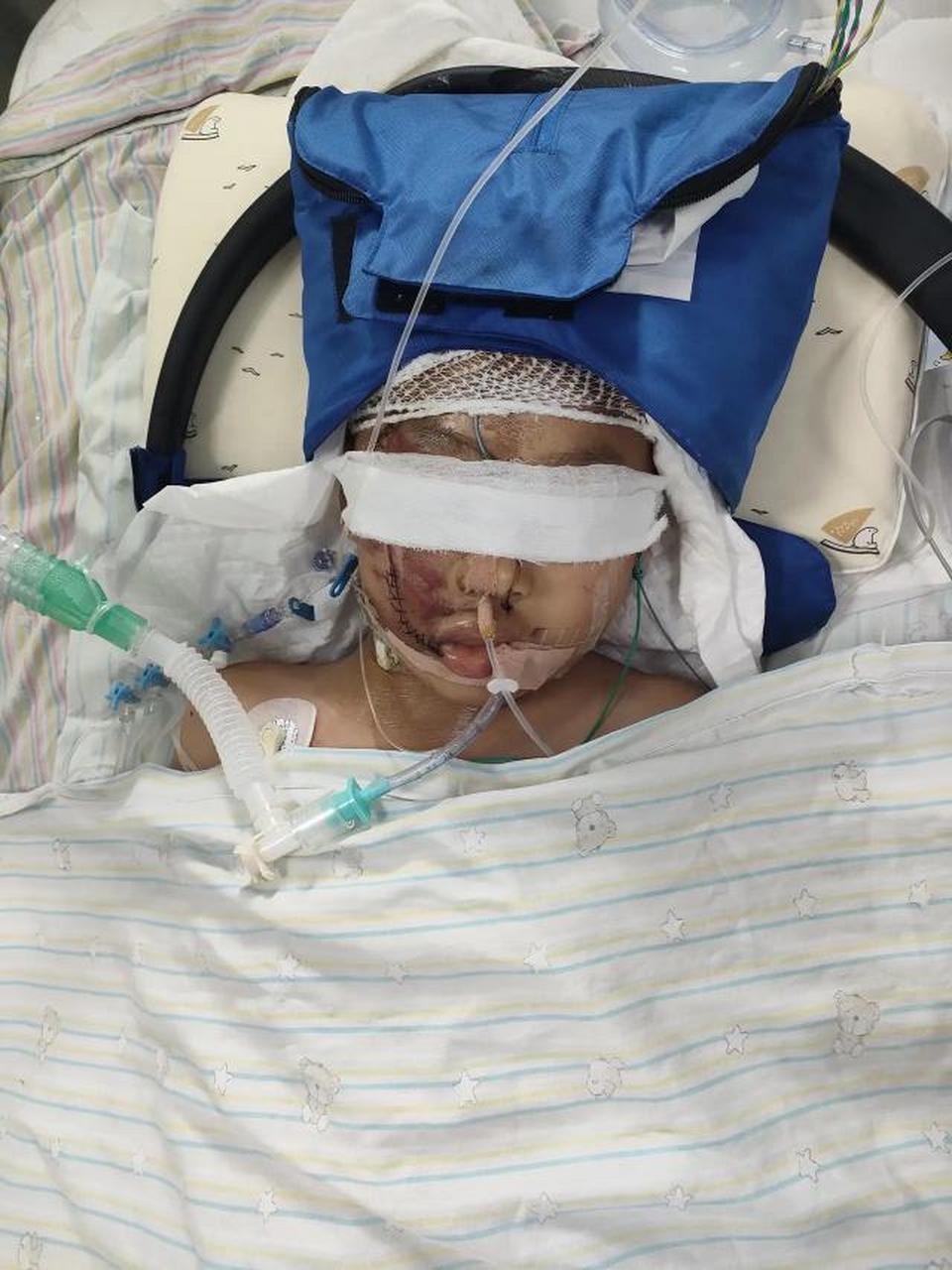 #10岁孩子被跳楼者砸中昏迷不醒#7月7日,河北沧州.一男童在楼下玩耍时