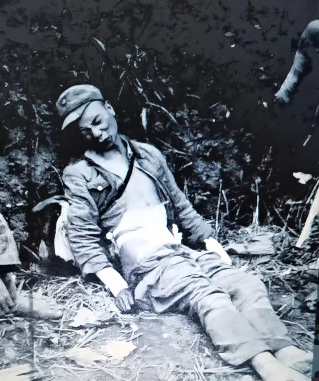 受到战场恶劣的环境和条件限制,卫生兵只是用纱布对他受伤的腹部进行