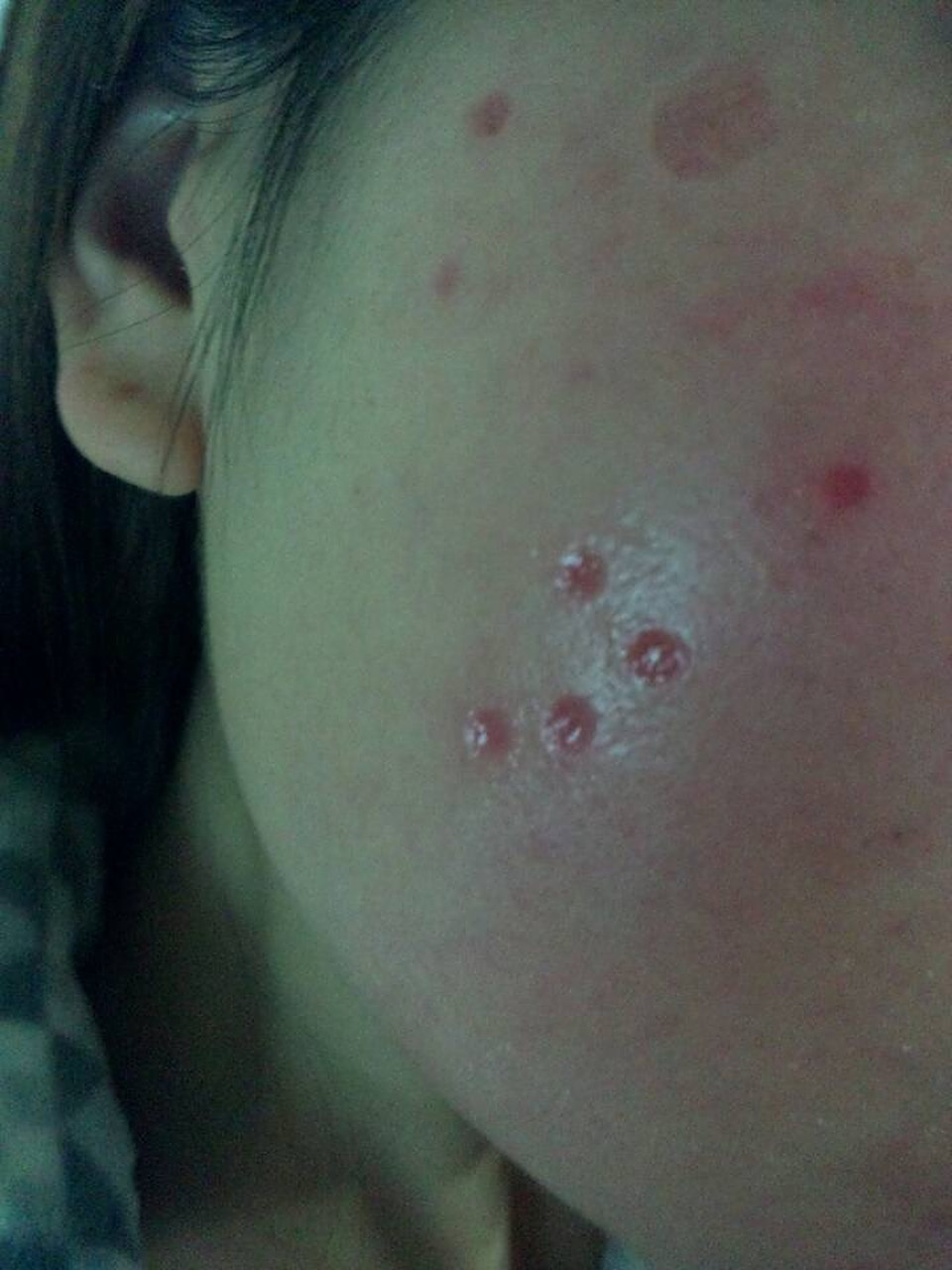 通常,恢复时间可以分为以下几个阶段:  创伤期(2