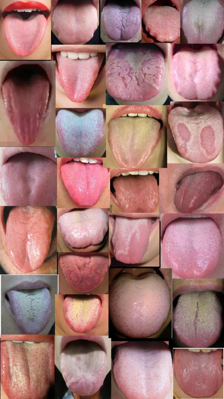 一分钟教你识别,4种脾虚舌象 很多朋友都对中医舌