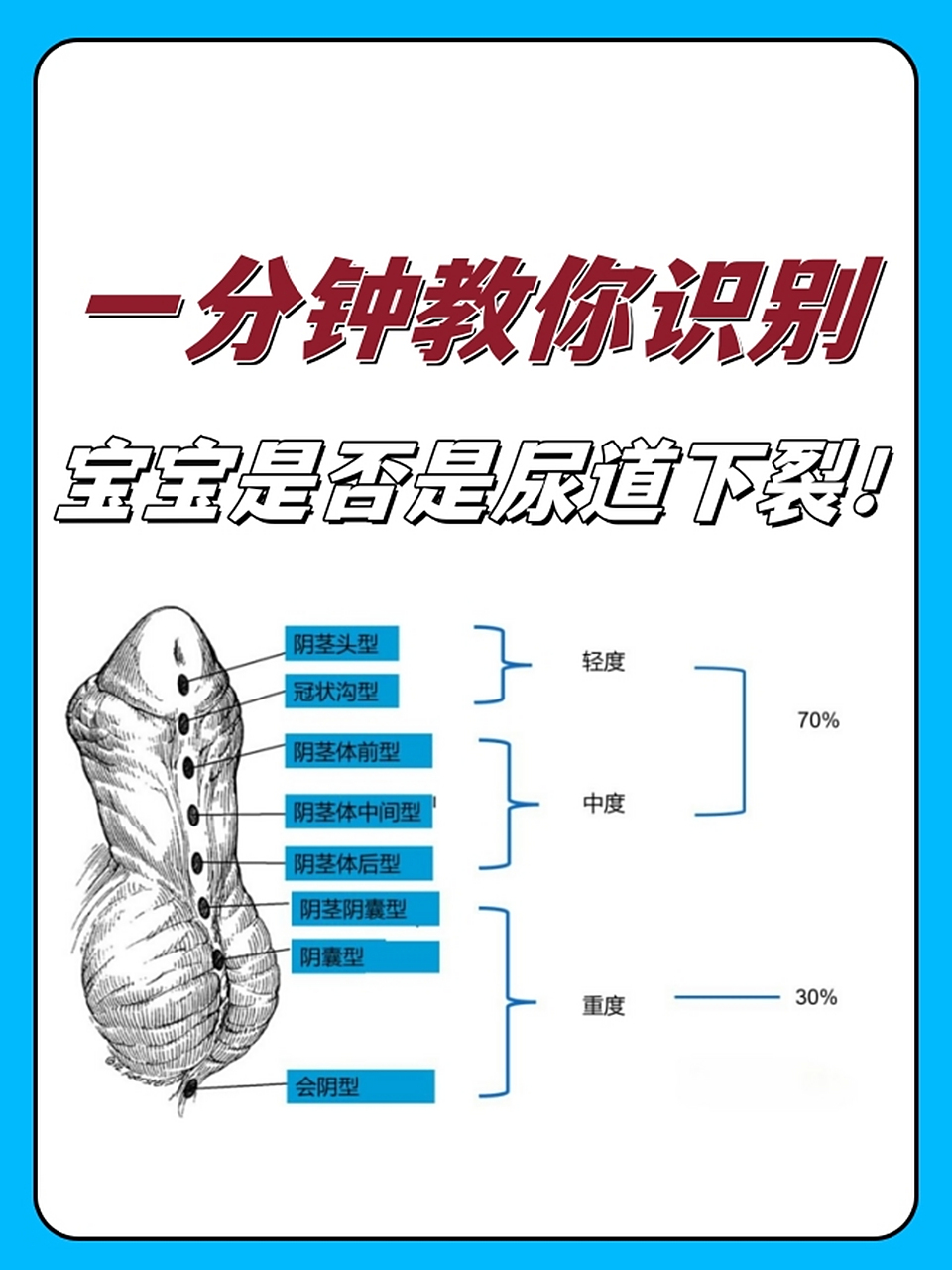 很多男性在医院检查之后才能够确定是尿道下裂的现象,但自己在家却