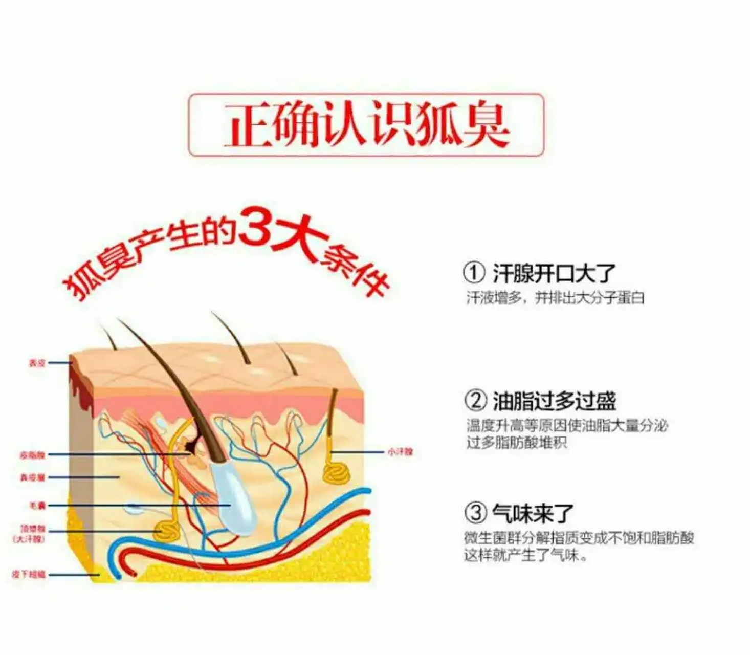 狐臭是咋形成的?#惠州皮肤科医院#   第一,首先考虑是遗传因素.