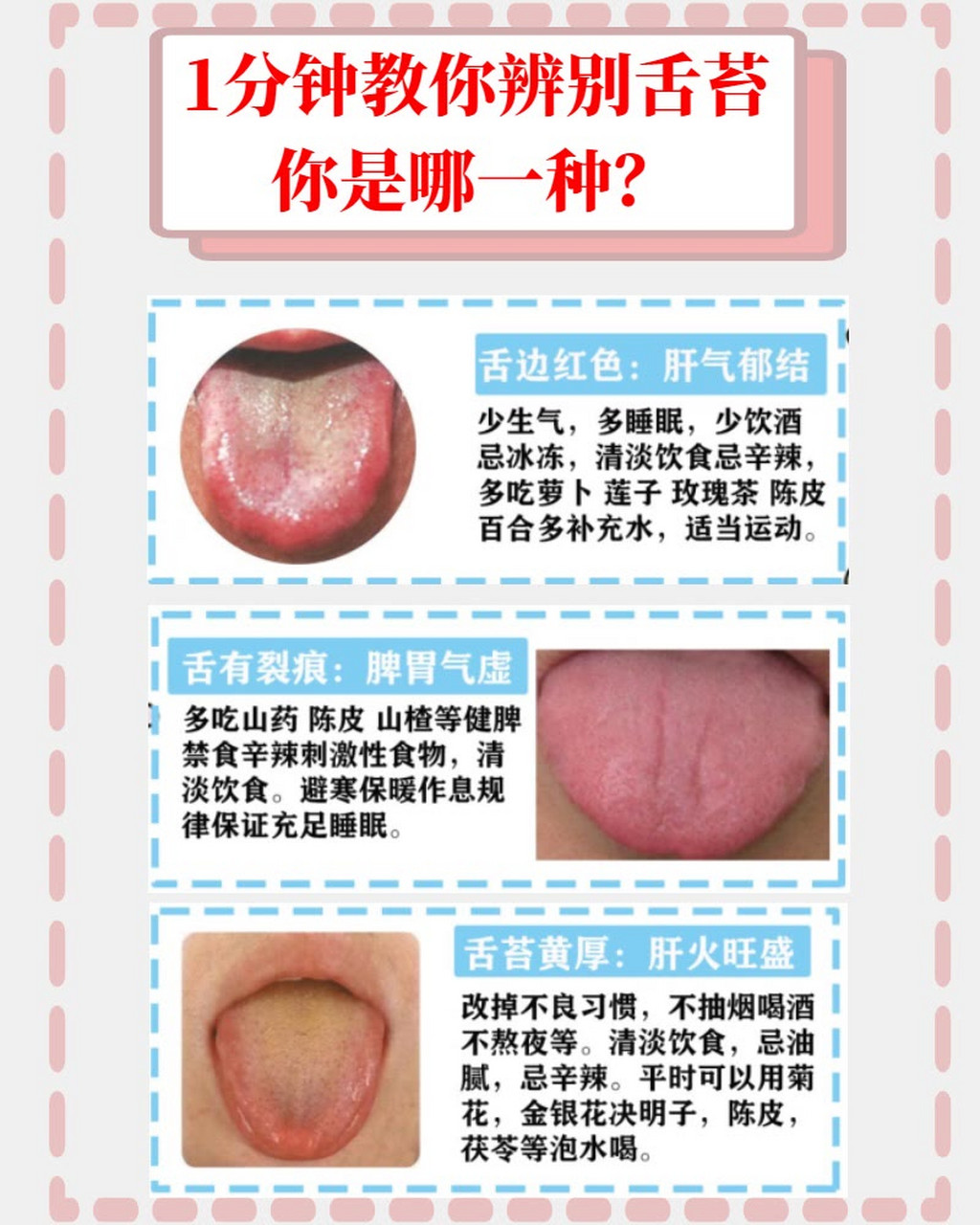 肝郁气滞的症状图片