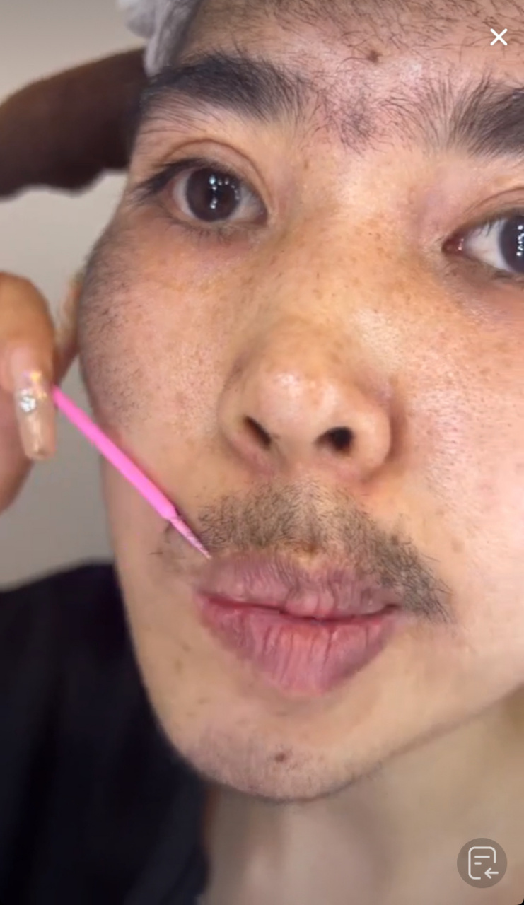 全脸长毛 额头上也长毛