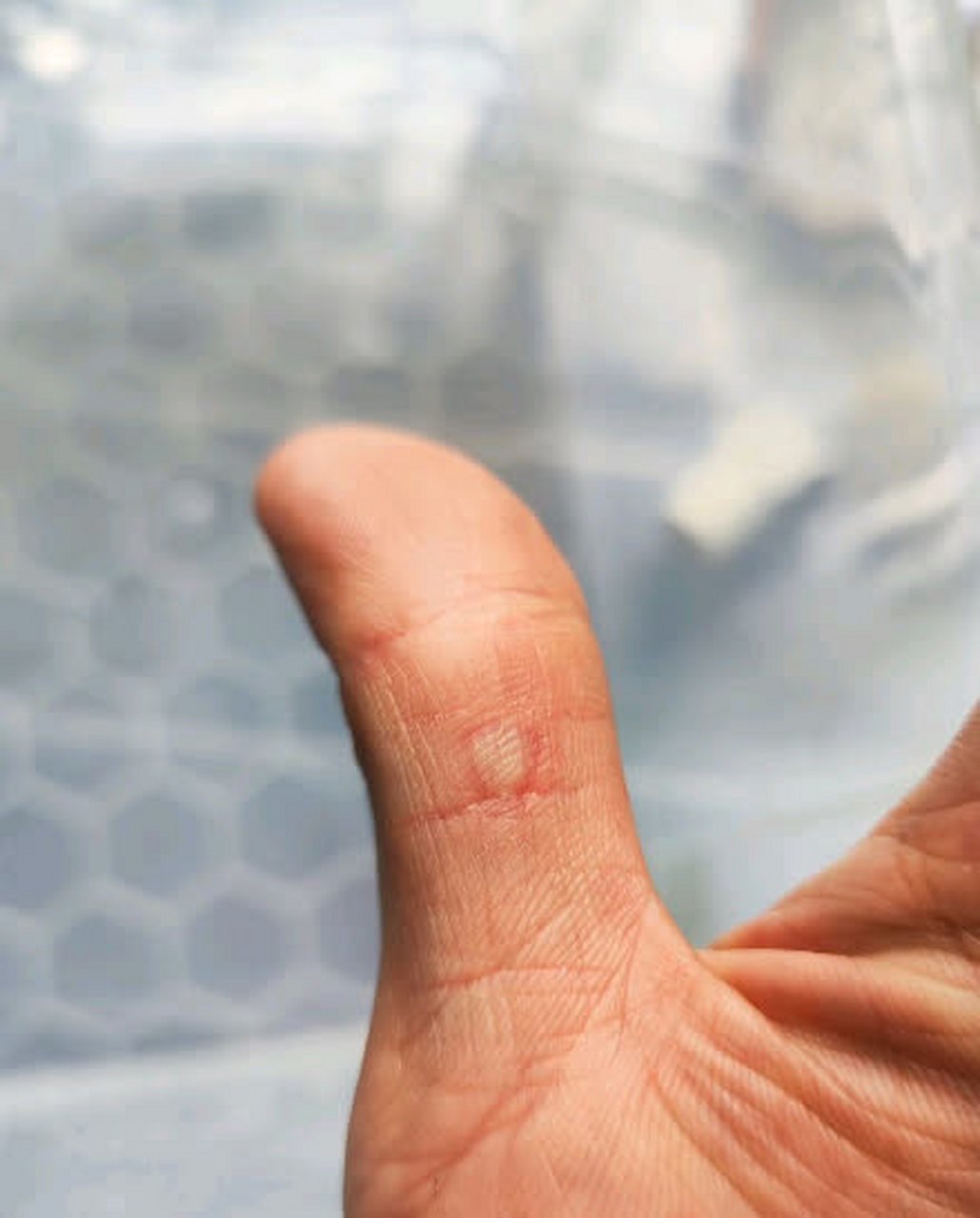 被乌龟咬了,还需要打狂犬疫苗吗?#搞笑趣图