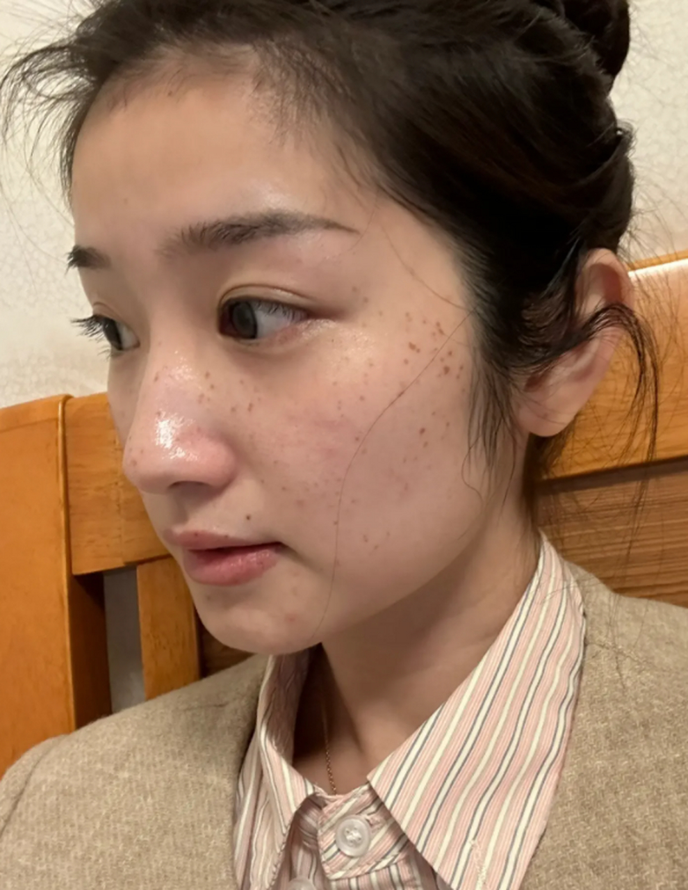 通过长期的护理和实践,我积累了一些淡化颧骨两侧斑点的禁言,现在分享