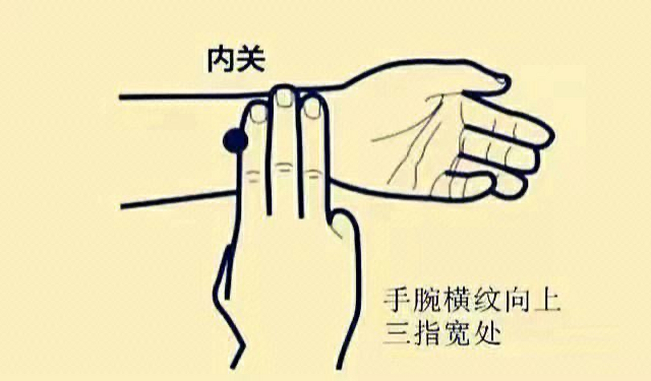 脑供血不足,经常头昏脑涨,多按这两个穴位会有改善 1,百会穴:在头部