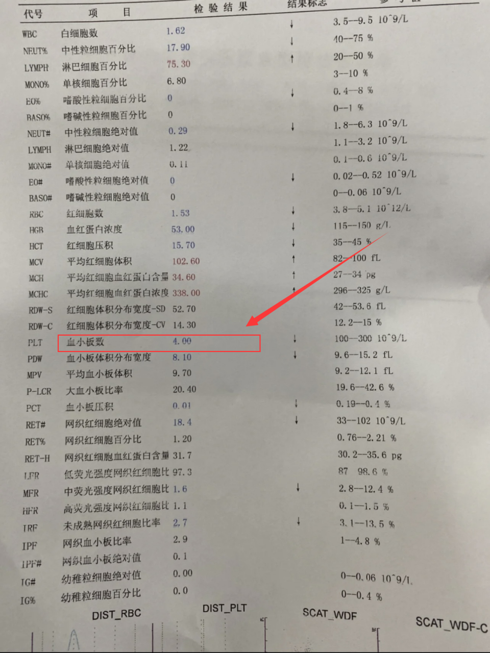 白血病可以表现为血小板减少,同时伴有白细胞异常和贫血.