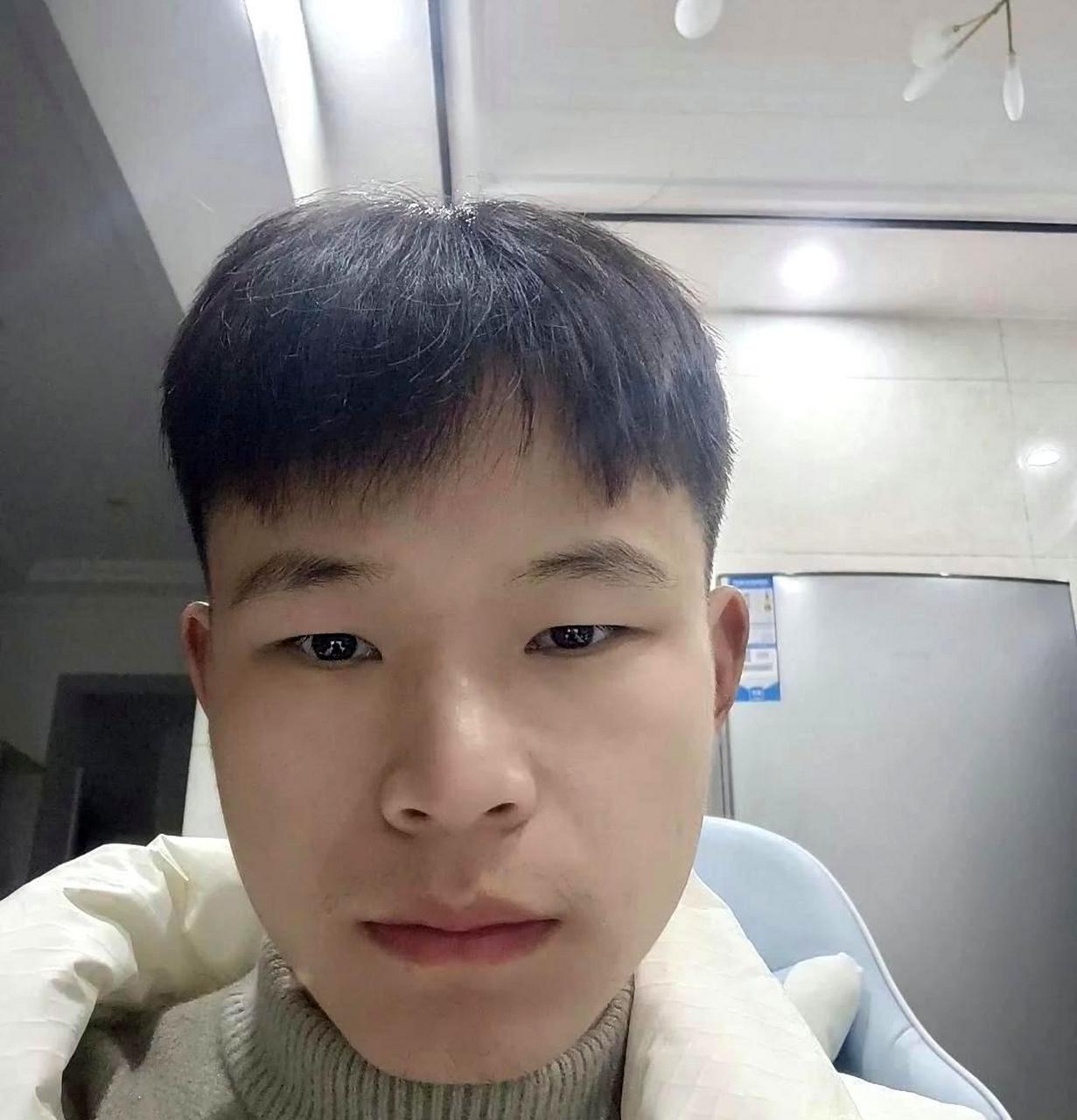 你认为帅哥割了双眼皮后不如以前迷人了吗?