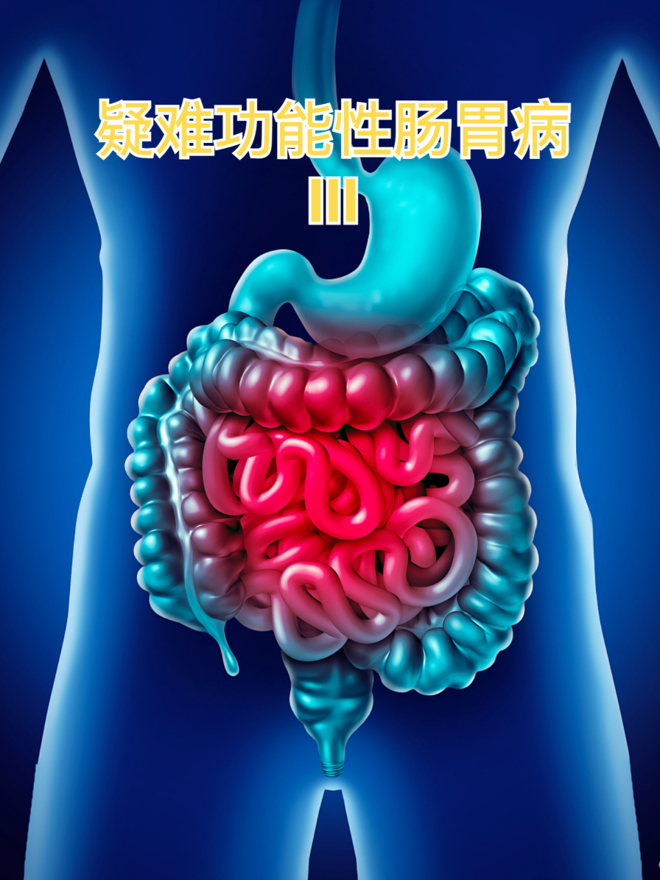 疑难功能性肠胃病 iii #胃炎# 胃病三分治七分养[悠闲] 很多没有器质