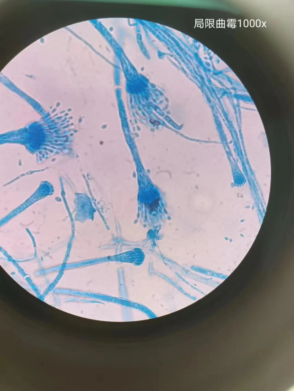 分享在进修期间看到的各种真菌形态