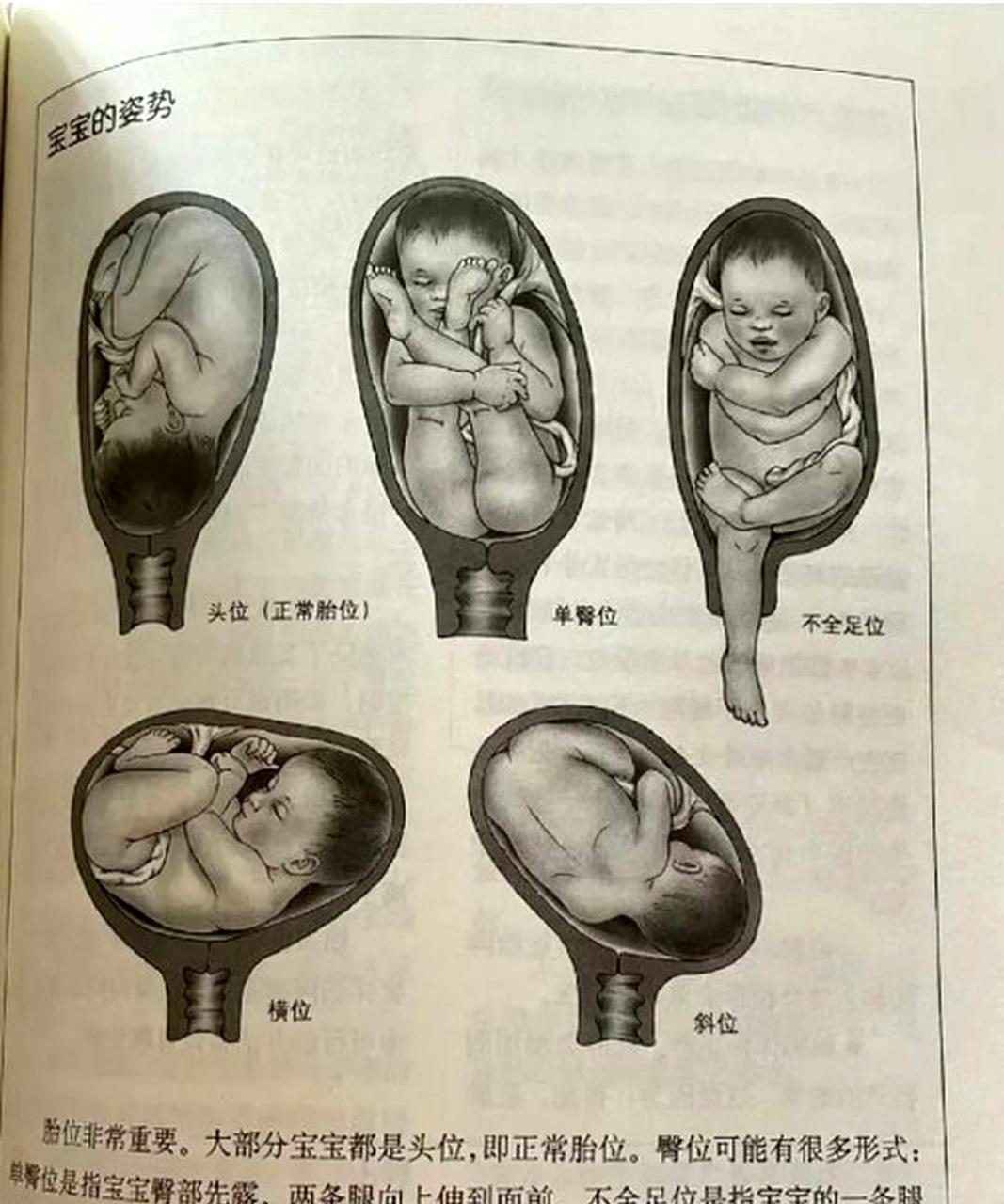 在医疗条件不完善的时代,遇到胎位异常的情况,女性生孩子就像面临着