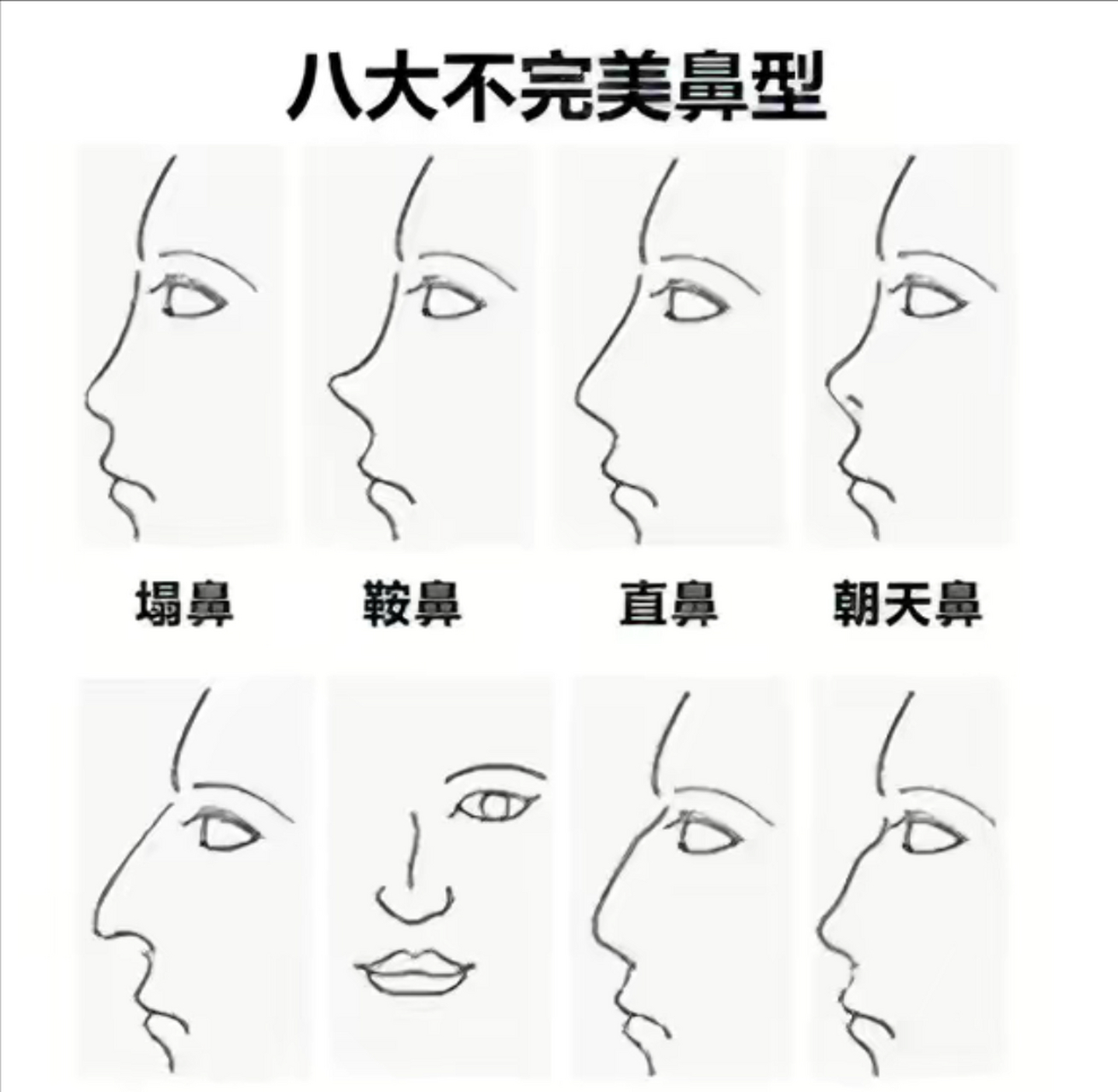 网友:八大不完美鼻型,你是哪一种? #搞笑趣味图