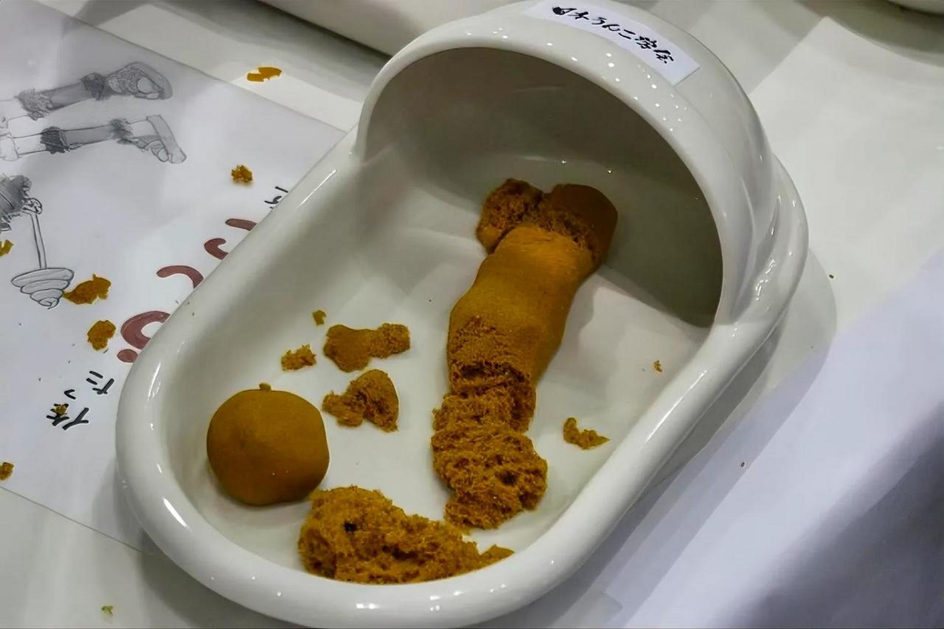 吃屎还需要预约,并且还需要提前半年时间预定金粒餐是一种利用十几岁