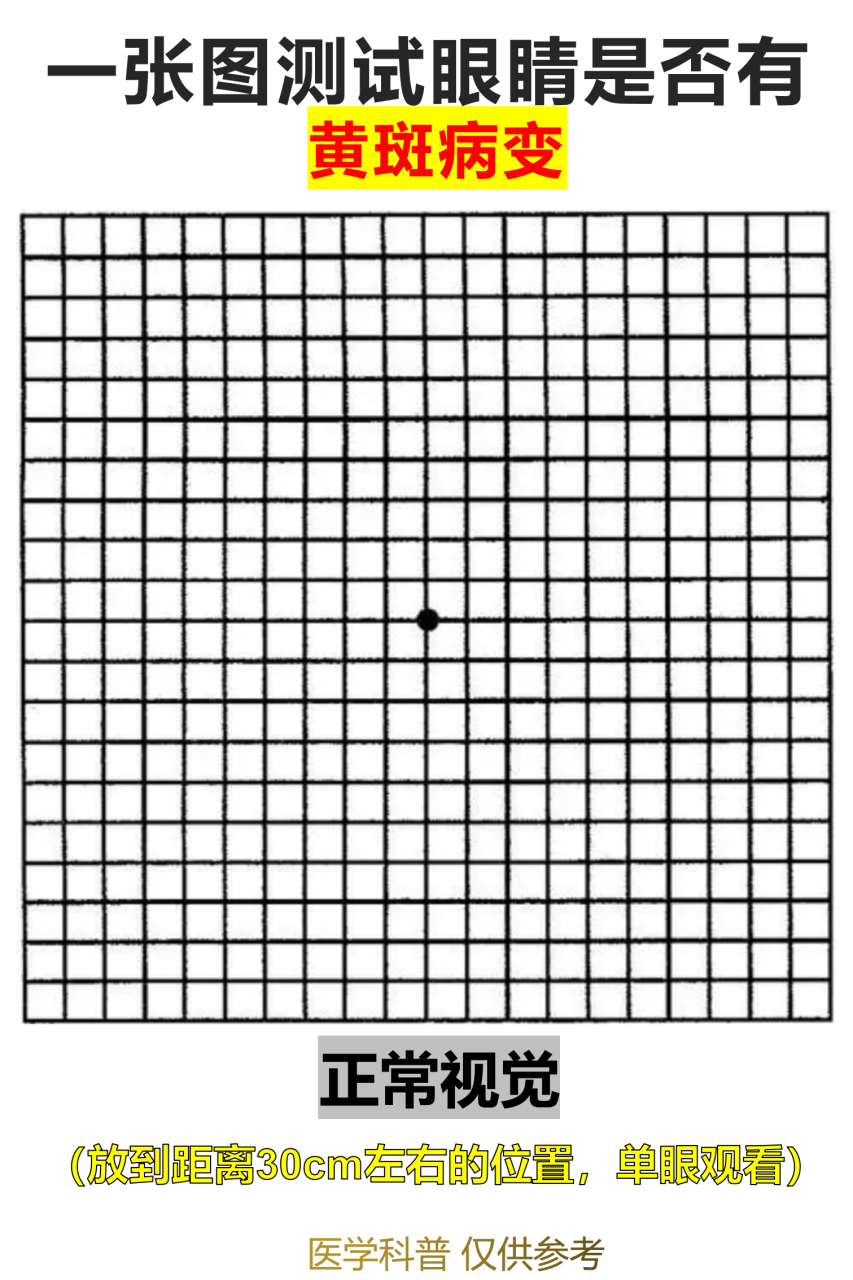 自测黄斑病变的方格图图片