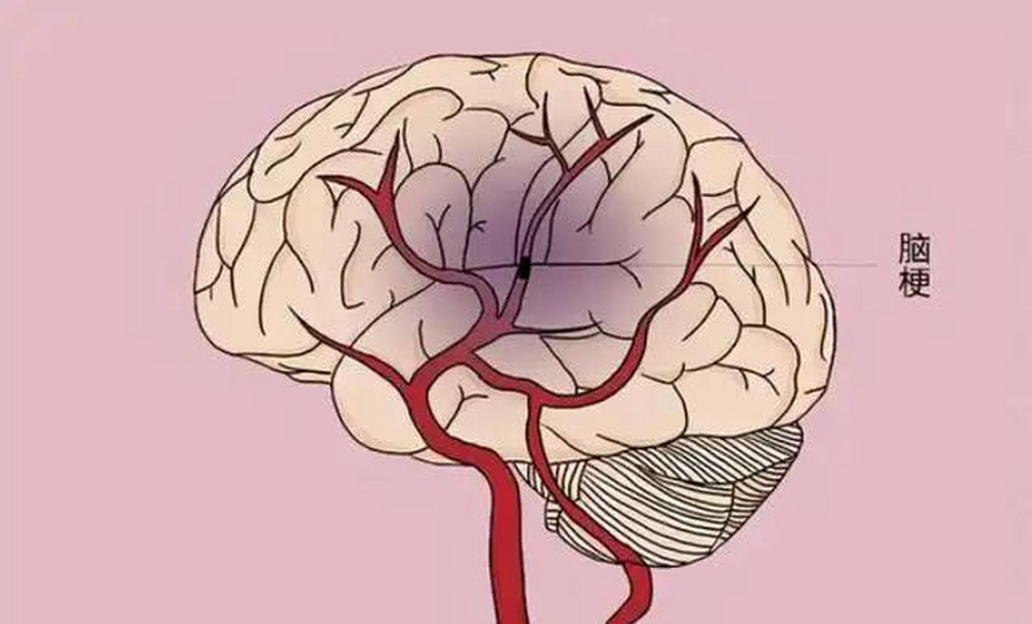 脑供血不足的7个表现,很多人都忽视了!