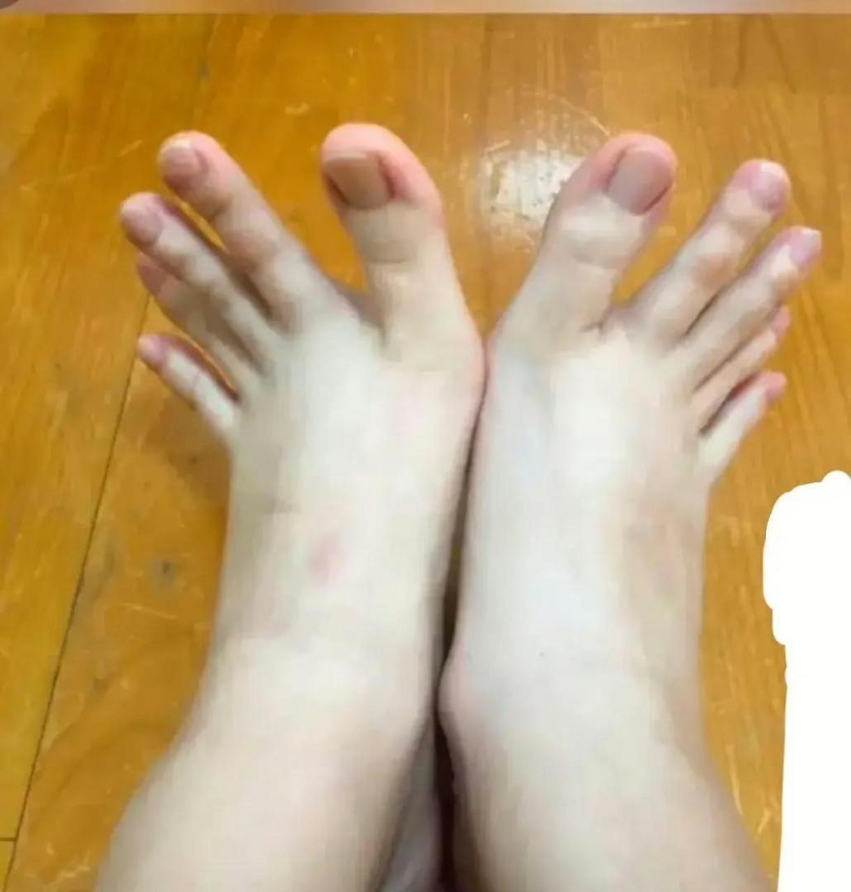 网友:这脚趾头长得,比我的手都灵活[捂脸][捂脸]