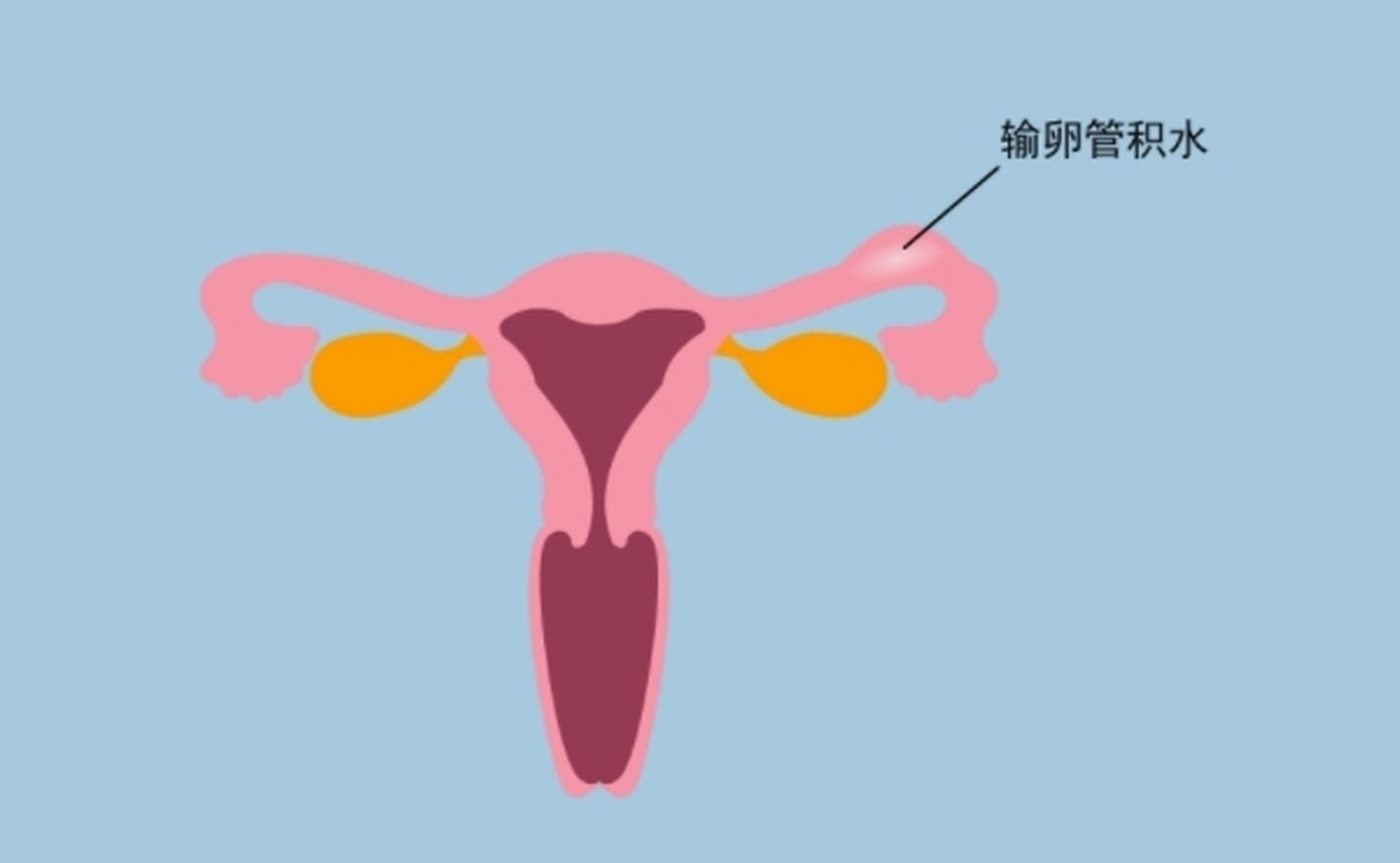 输卵管的形状图片