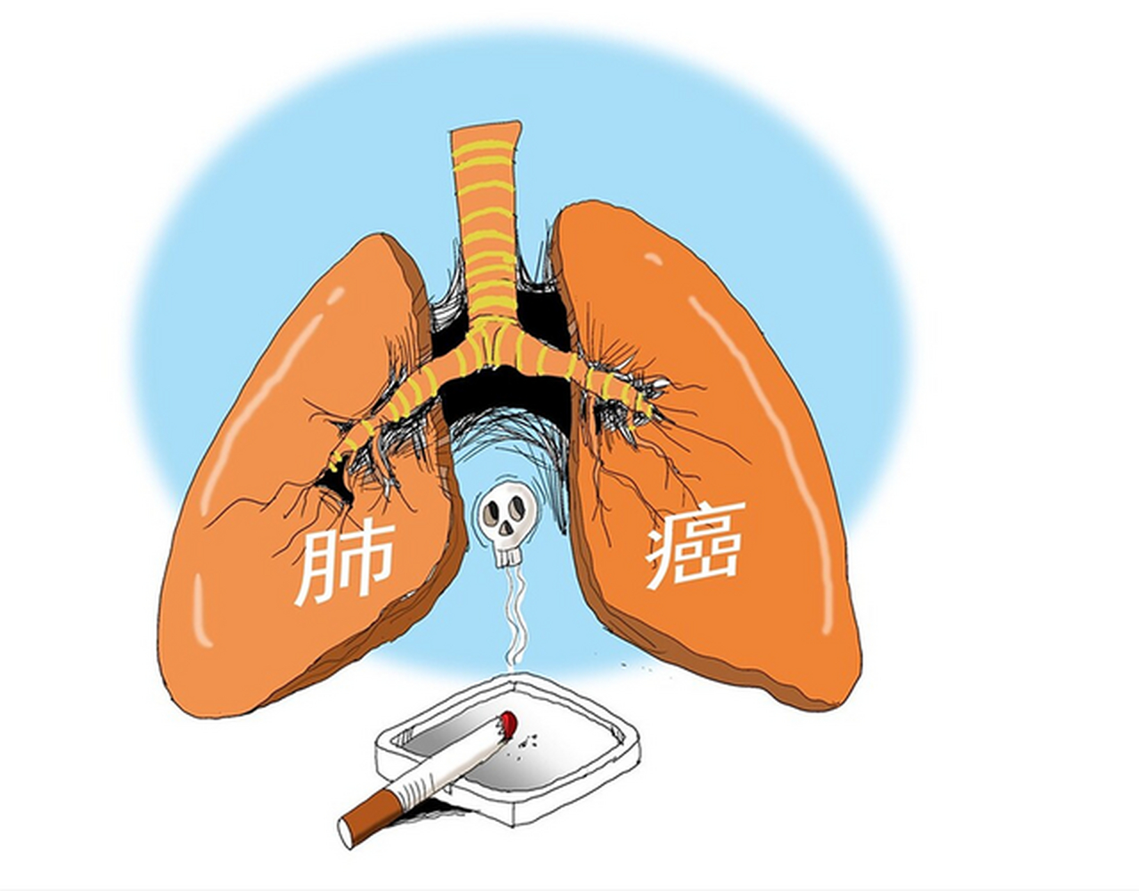 体内有"结节"的人,5种"发物"要少吃,忍住不吃或能赢