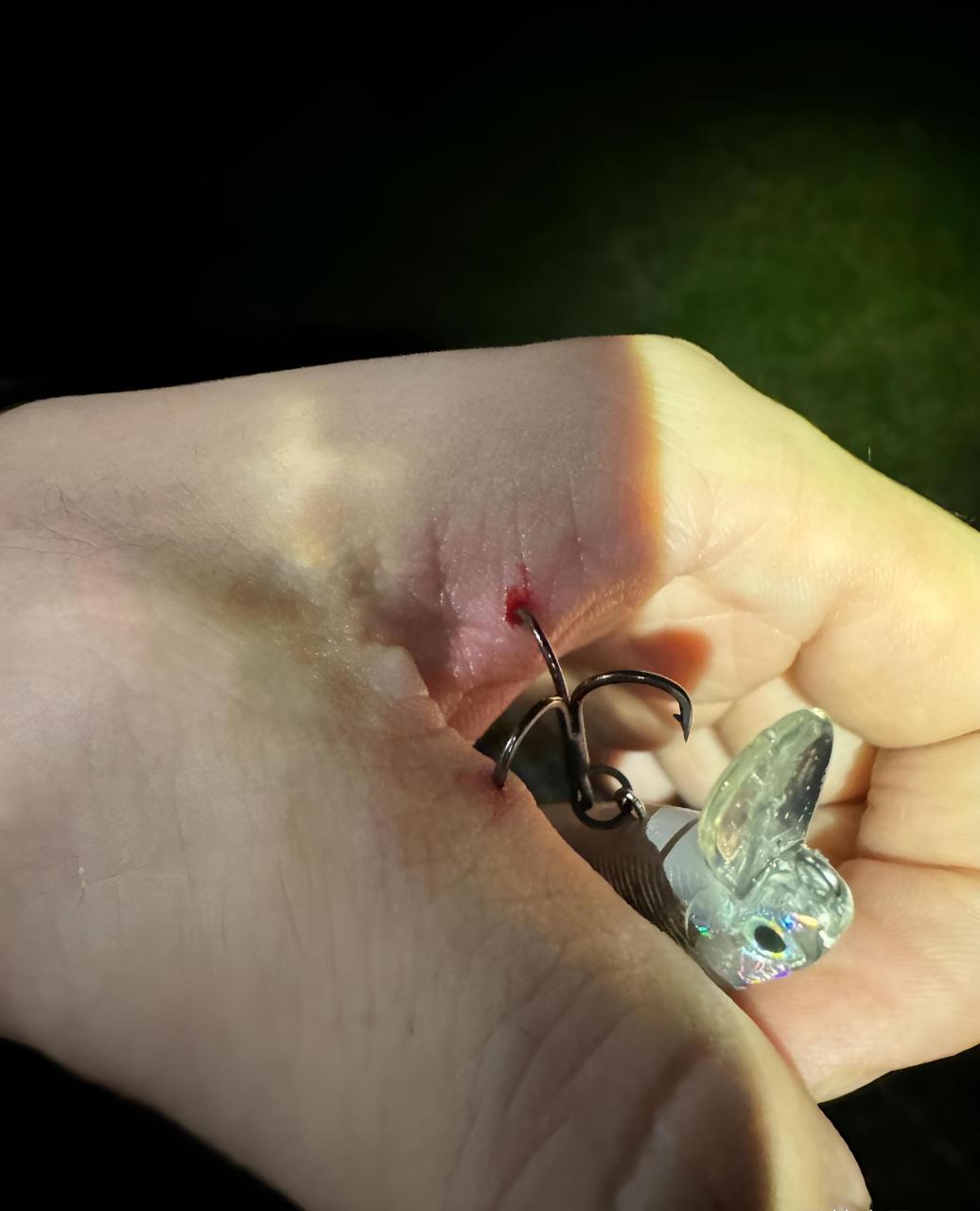 单位同事嫌急诊不够忙,钓个鱼还把自己给掉上来了,笑死了