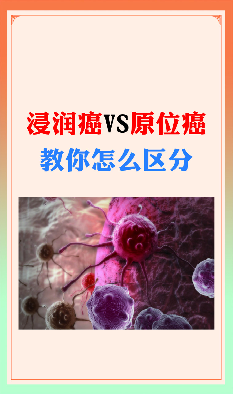同样是癌,浸润癌和原位癌有什么区别?