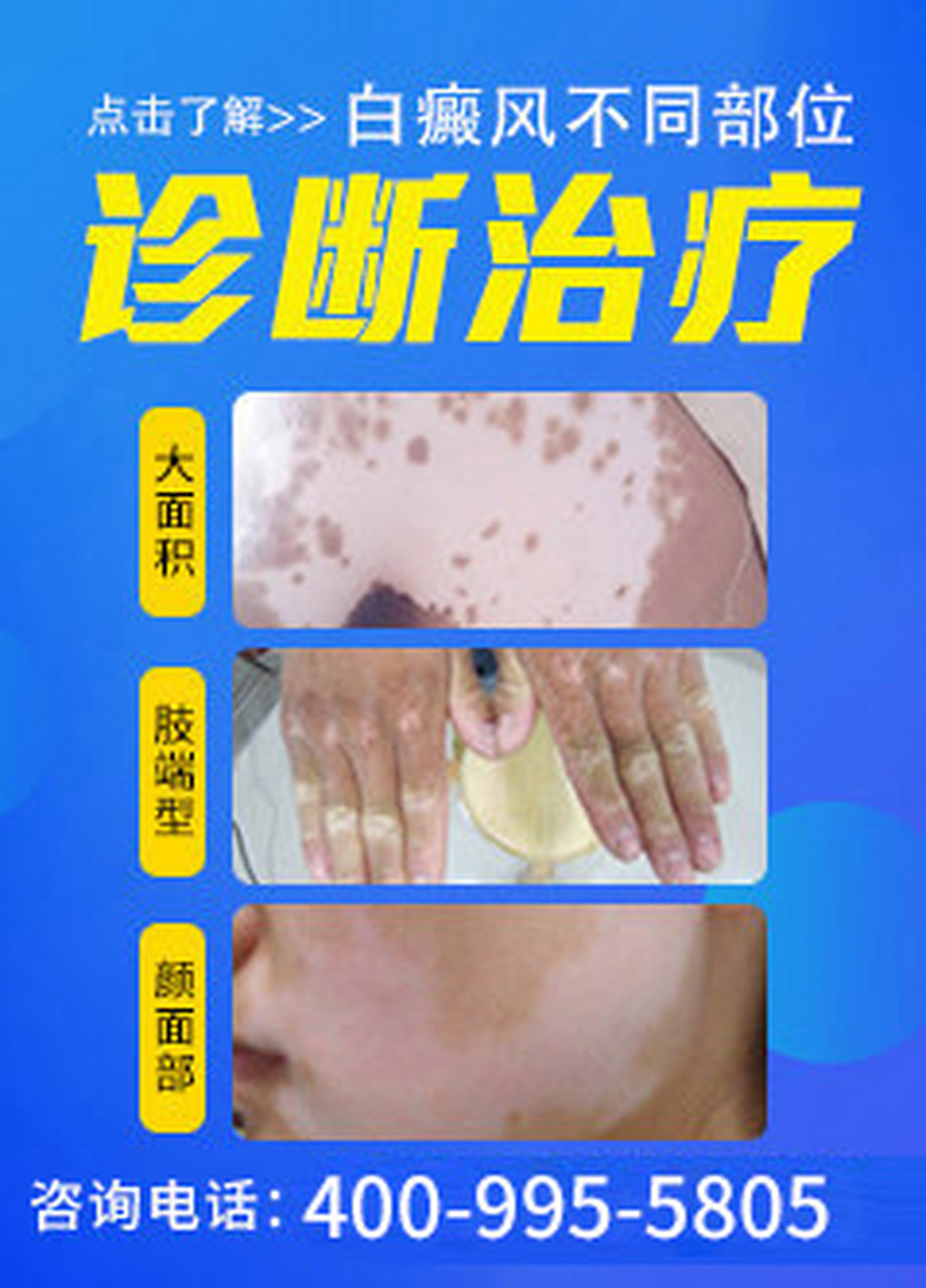 昆明白癜风# #昆明复美白癜风门诊# 这些微量元素对于白癜风的治疗不