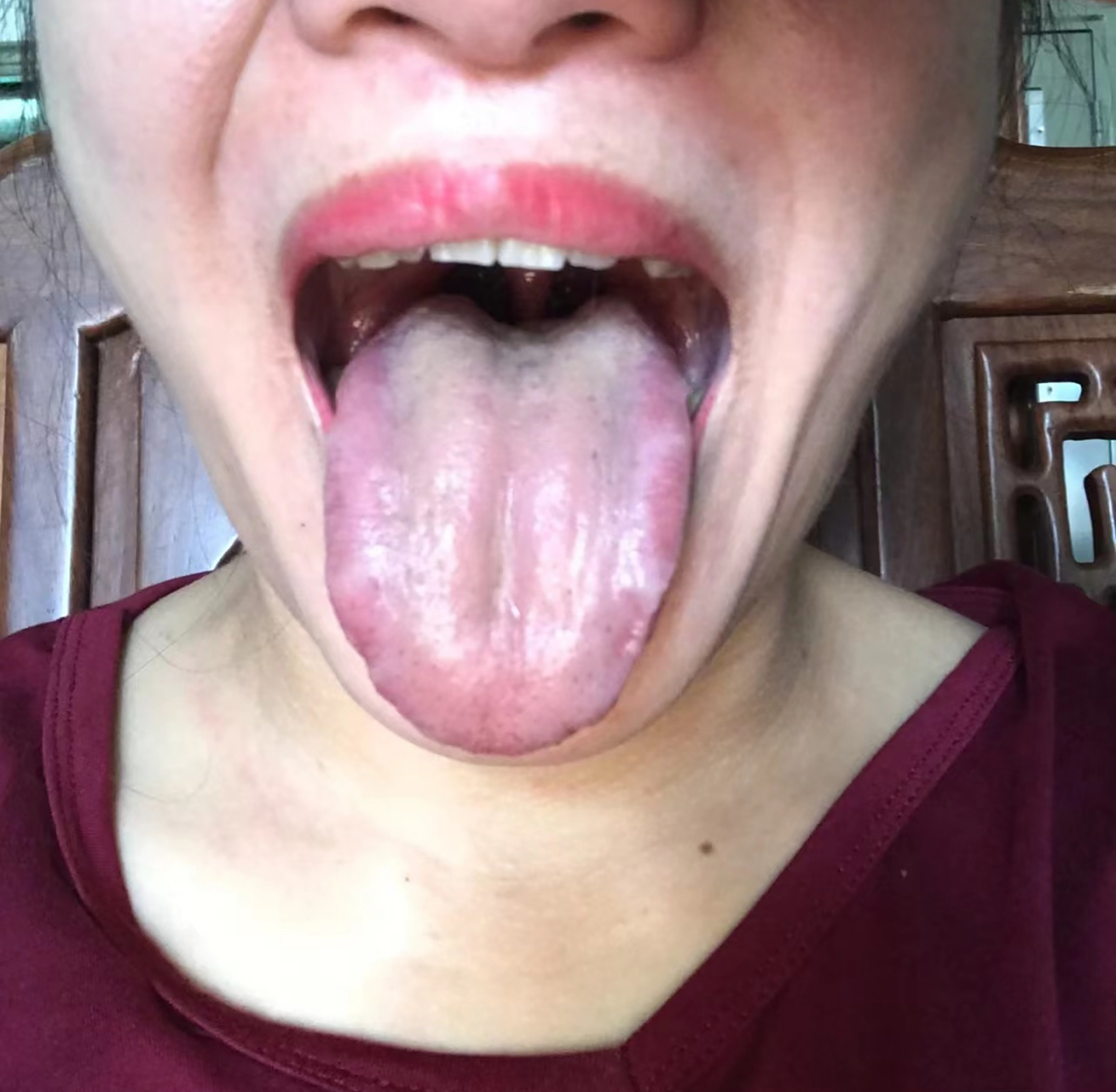 舌边鼓胀,肝气郁结,肝气不舒,容易出现,急躁易怒,两肋胀痛,肋下胀痛心