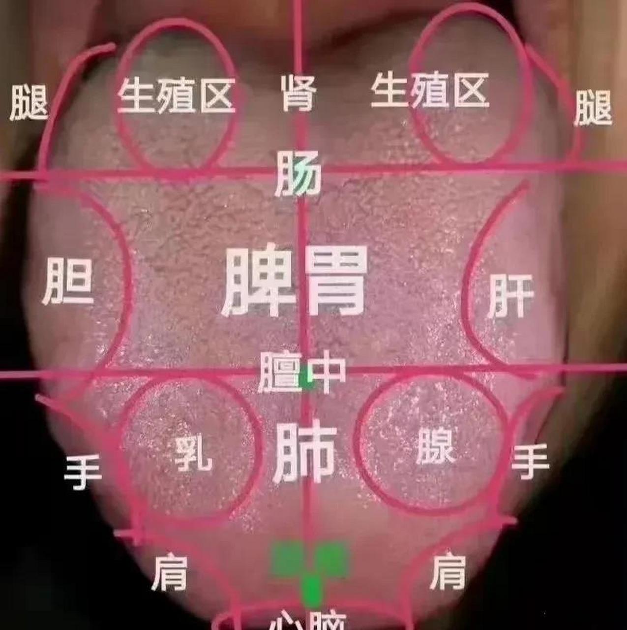 中医舌诊分析,7张舌诊案例教你看舌诊[机智]#你相信中医吗# #健康科普