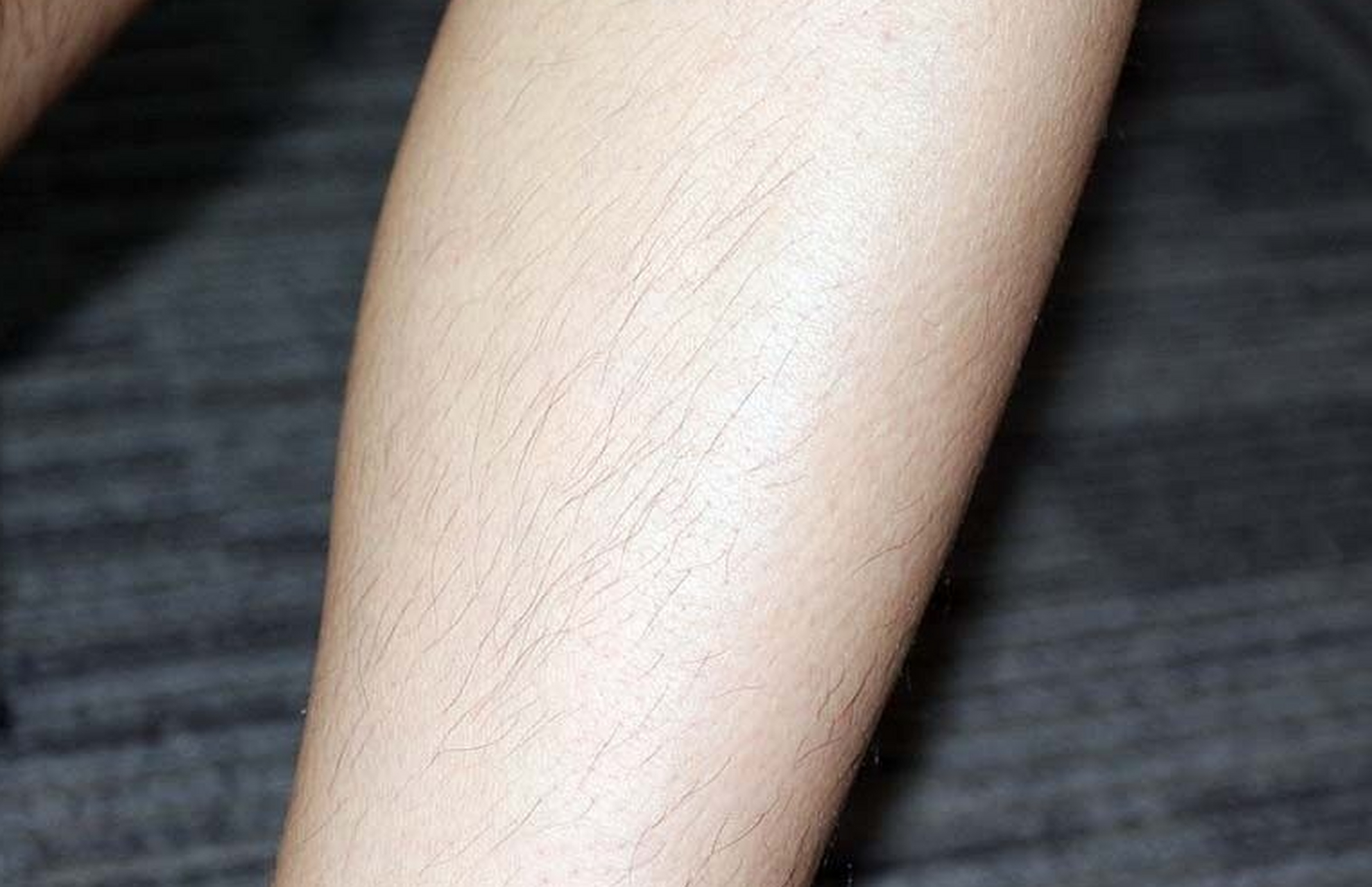 去掉腿毛的普通方法 #医美科普挑战赛#  当涉及到去除腿毛的时候,有