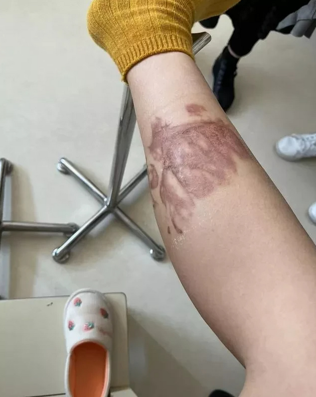上海的雷女士剖宫产生下了二宝,为了能让产妇和宝宝得到更专业的护理