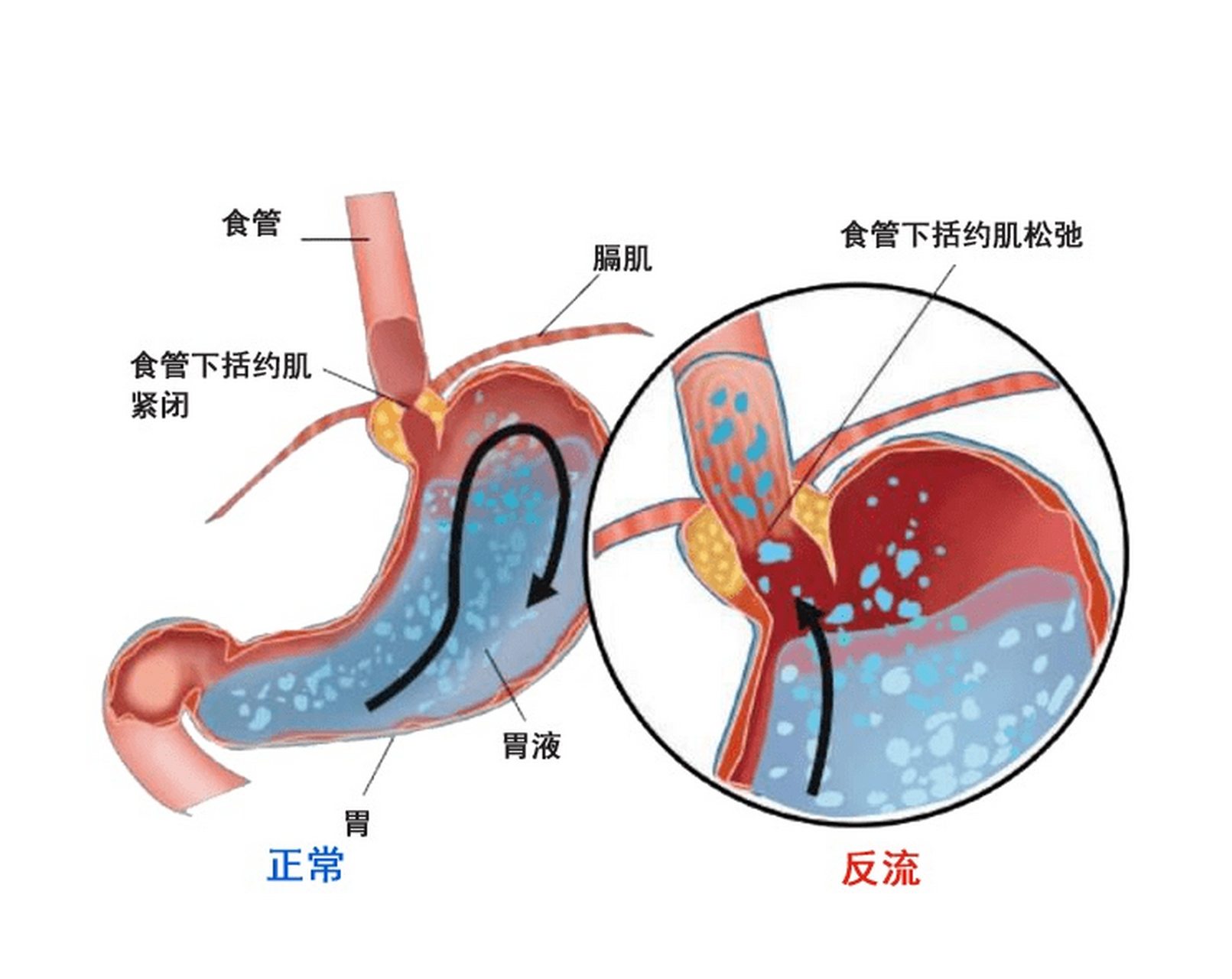 钡餐液图片