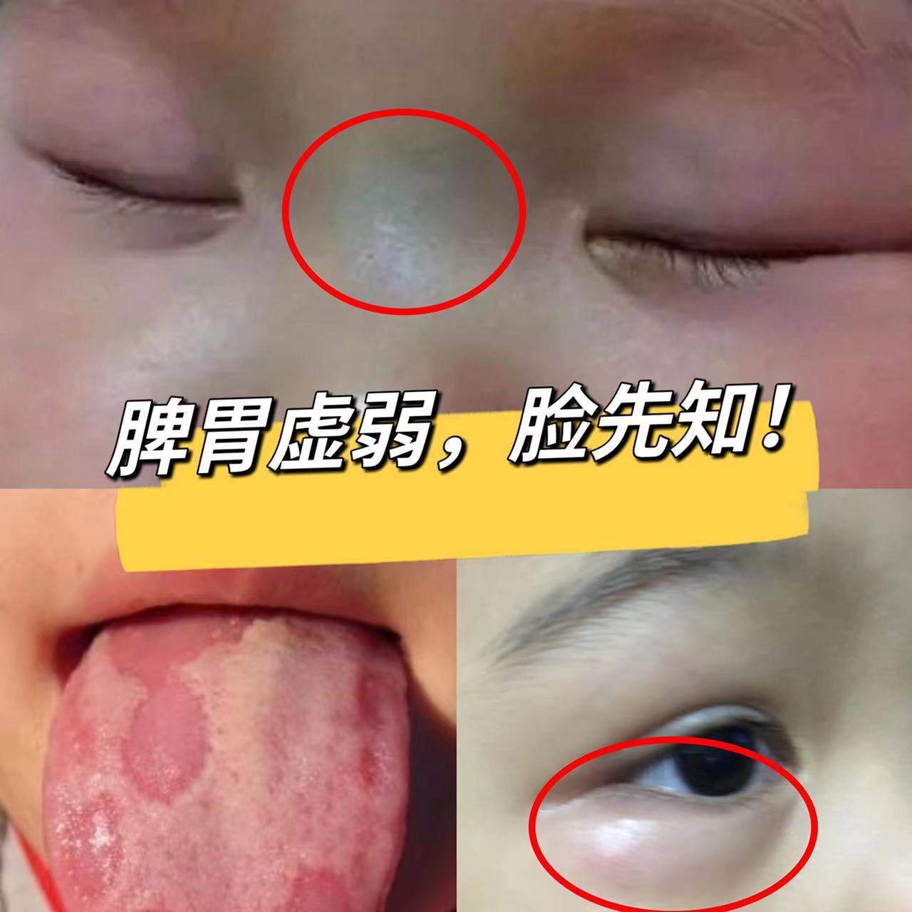 1,面色发黄或者脸颊正中央潮红,脸上有白斑,皮肤干燥,粗糙.