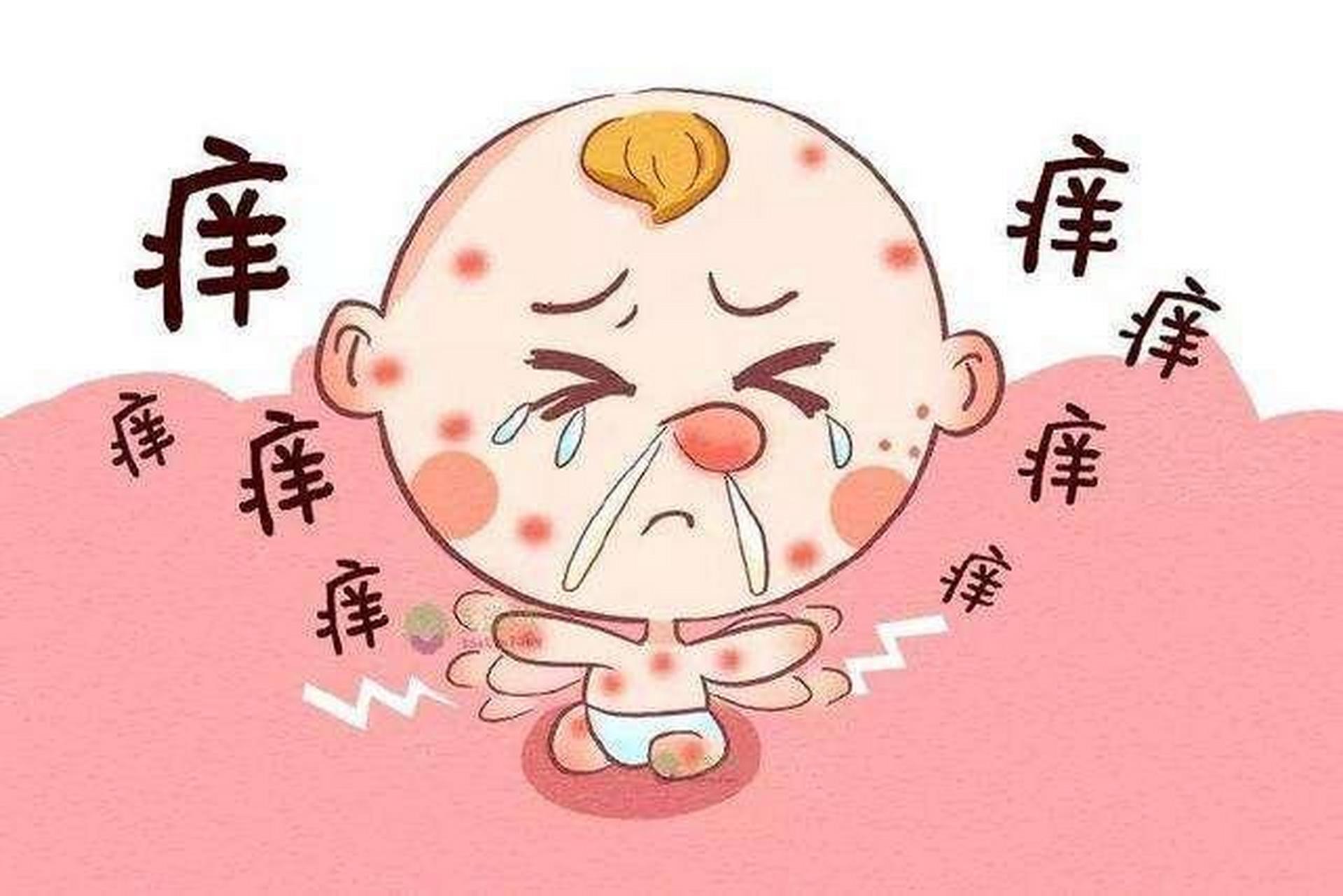 丘疹型荨麻疹,又叫虫咬皮炎,是昆虫叮咬后发生的过敏性皮肤病,在临床