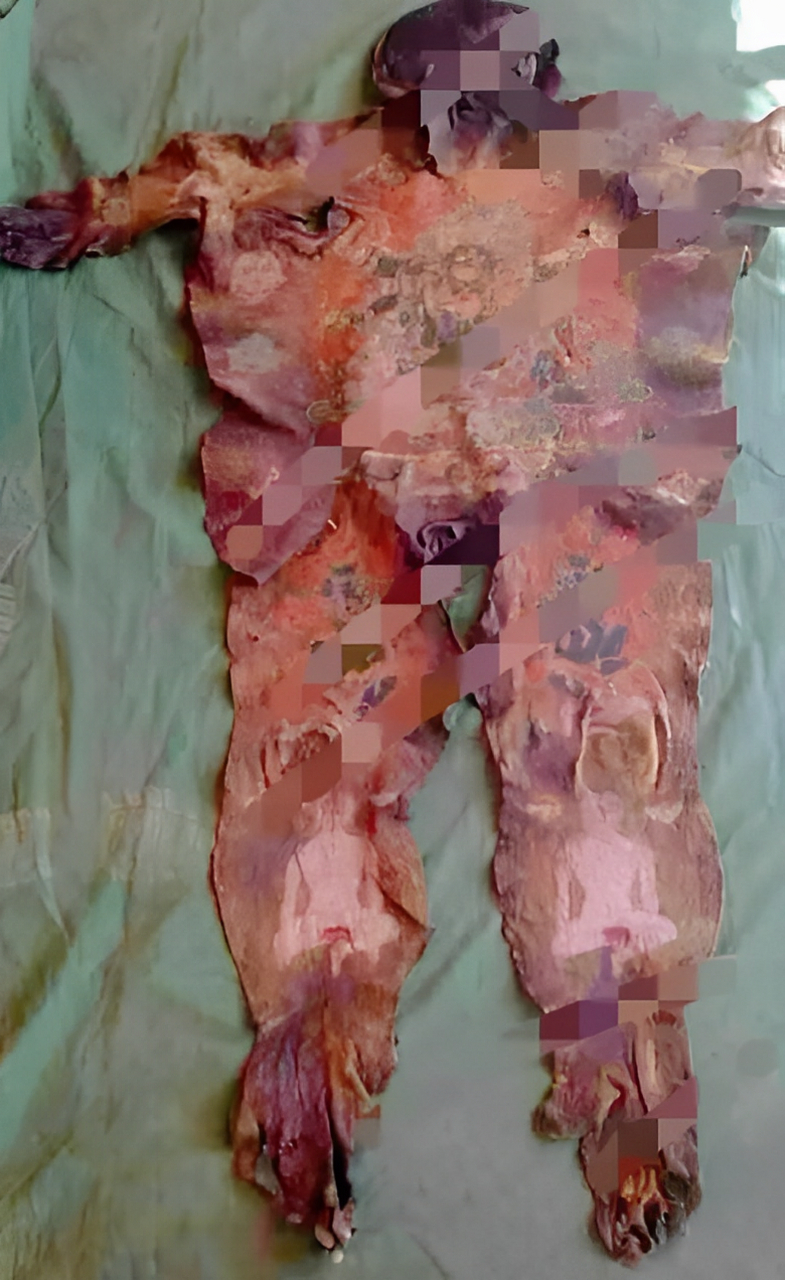 据传说,这张人皮是由寺庙中著名的"佛活"当秋炎培和龙治剥下来的!