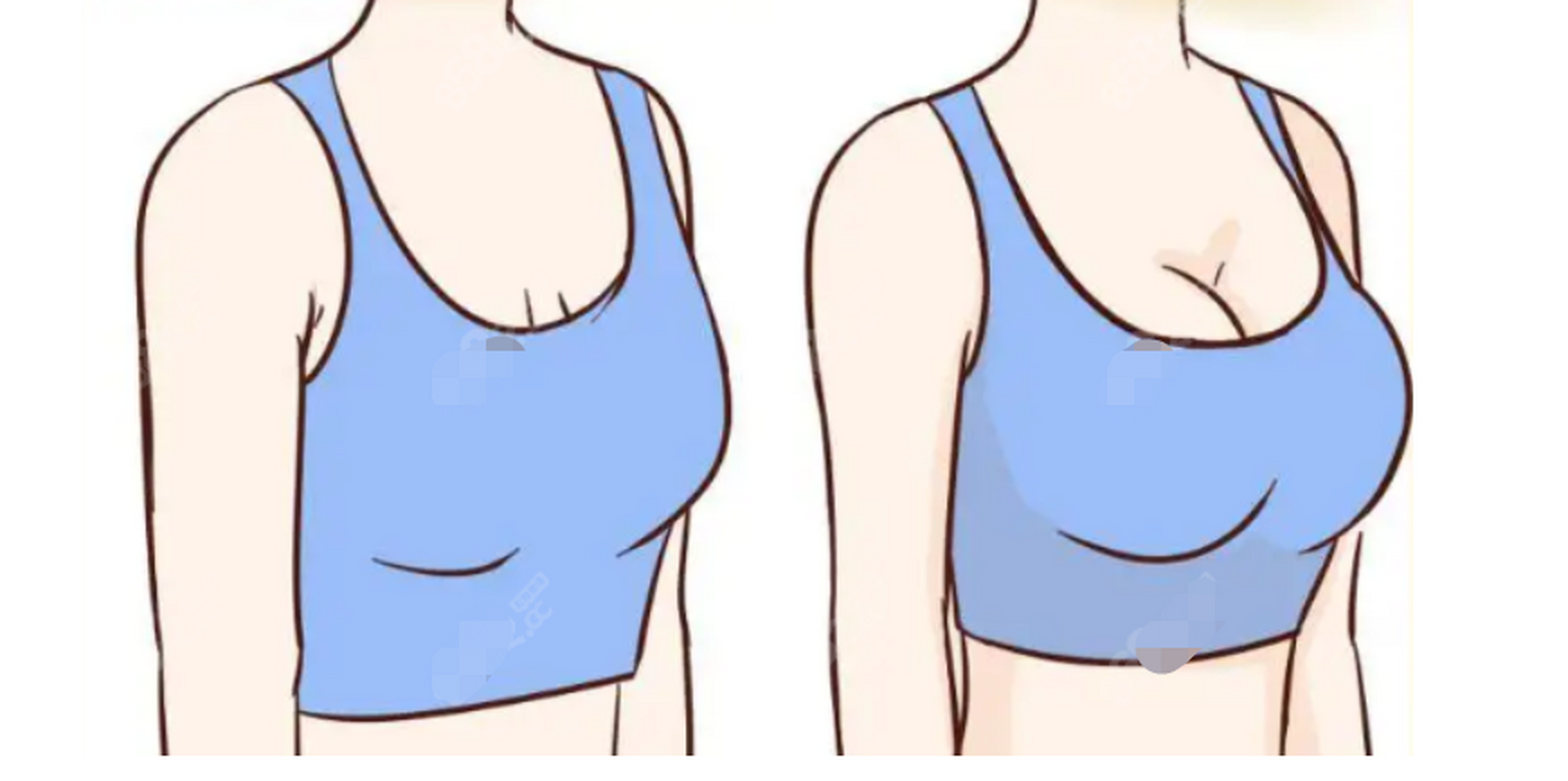 "按摩丰胸"宣传的作用,一是按摩能将其他部位的脂肪转移到乳房,二是